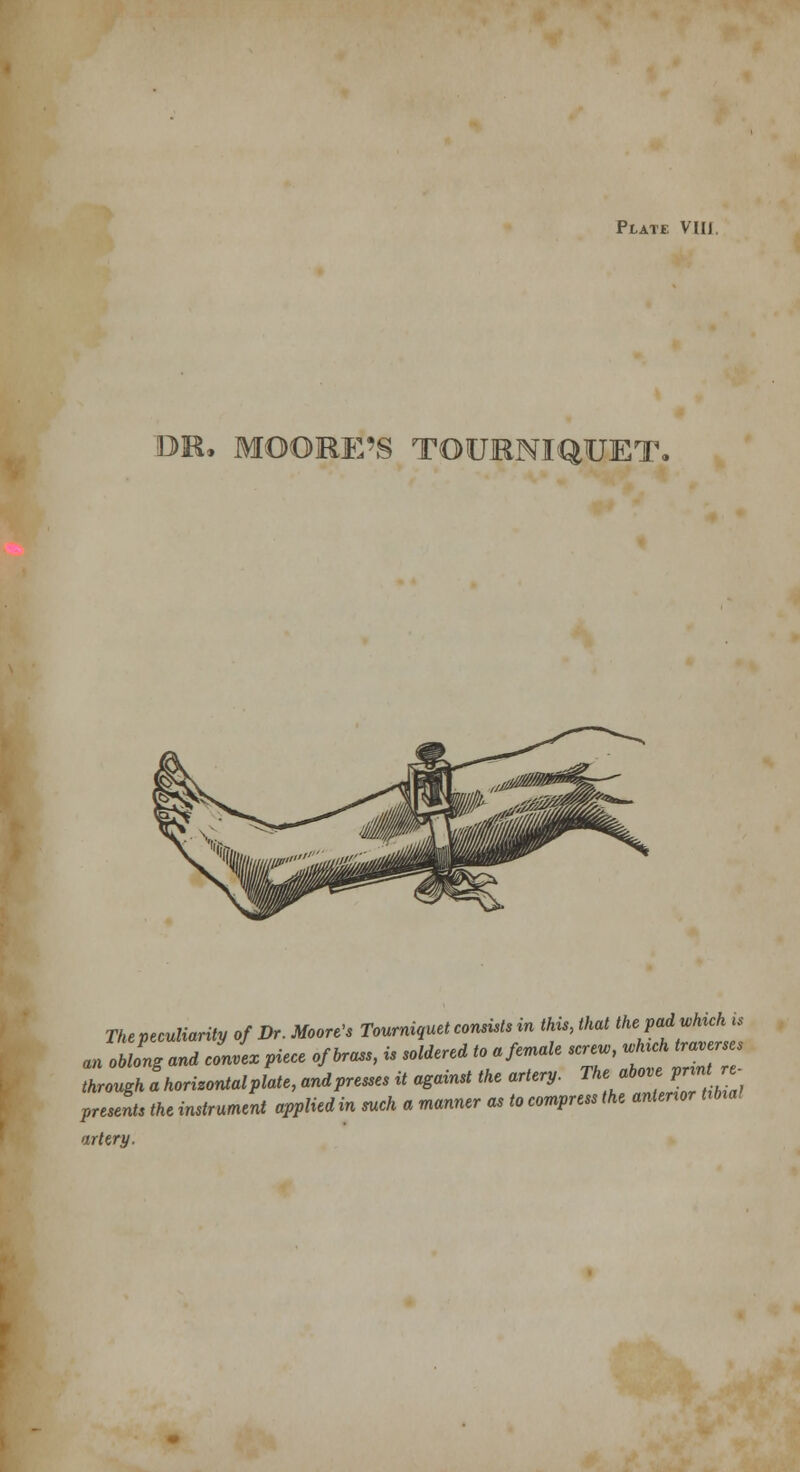 Plate VU1. OK, MOORE'S TOURNIQUET. The peculiarity of Dr. Moore's Tourniquet consists in this, that the pad Mu an oblong and conL piece of brass, is soldered to a female sere,, whtchtrav erses through ahorizontalplate, andpresses it against the artery. The above pnn- presents the instrument applied in such a manner as to compress the antenor Ubia! artery.