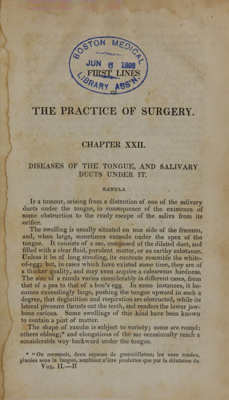 THE PRACTICE OF SURGERY. CHAPTER XXII. DISEASES OF THE TONGUE, AND SALIVARY DUCTS UNDER IT. RANULA Is a tumour, arising from a distention of one of the salivary ducts under the tongue, in consequence of the existence of some obstruction to the ready escape of the saliva from its orifice. The swelling is usually situated on one side of the fraenum, and, when large, sometimes extends under the apex of the tongue. It consists of a sac, composed of the dilated duct, and filled with a clear fluid, purulent matter, or an earthy substance. Unless it be of long standing, its contents resemble the white- of-egg; but, in cases which have existed some time, they are of a thicker quality, and may even acquire a calcareous hardness. The size of a ranula varies considerably in different cases, from that of a pea to that of a hen's egg. In some instances, it be- comes exceedingly large, pushing the tongue upward in such a degree, that deglutition and respiration are obstructed, while its lateral pressure thrusts out the teeth, and renders the lower jaw- bone carious. Some swellings of this kind have been known to contain a pint of matter. The shape of ranulae is subject to variety; some are round; others oblong;* and elongations of the sac occasionally reach a considerable way backward under the tongue. *  On reconnoit, deux especes de grenouillettes; les unes rondes, placees sous la langue, semblent n'etre produites que par la dilatation du Vol. II.—B