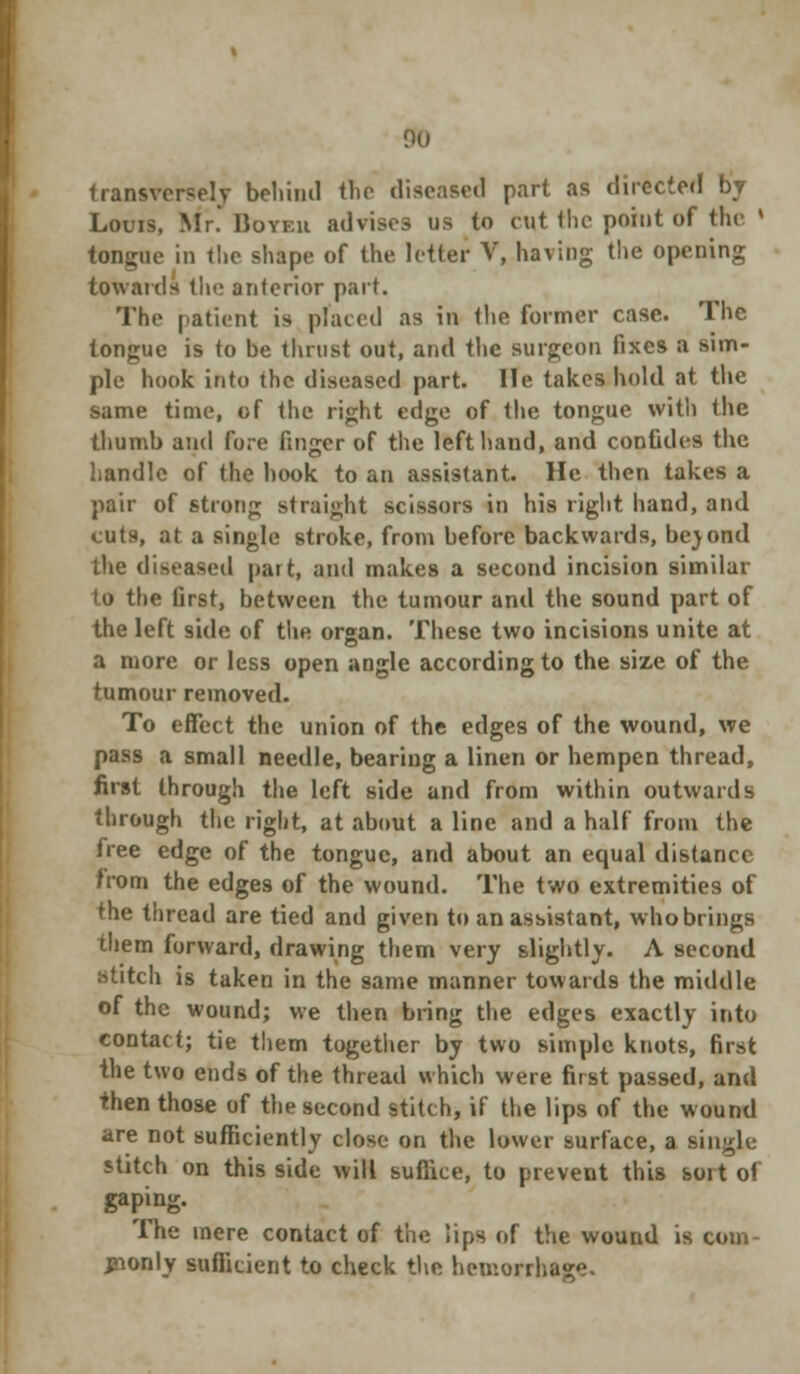 transversely behind tTie diseased part as directed by Louis, Mr.' Boyeii advises us to cut the point of the ' tongue in the shape of the letter V, having the opening towards the anterior part. The patient is placed as in the former case. The. tongue is to be thrust out, and the surgeon fixes a sim- ple hook into the diseased part, lie takes hold at the same time, of the right edge of the tongue with the thumb and fore finger of the left hand, and confides the handle of the hook to an assistant. He then takes a pair of strong straight scissors in his right hand, and cuts, at a single stroke, from before backwards, be\ond the diseased part, and makes a second incision similar to the first, between the tumour and the sound part of the left side of the organ. These two incisions unite at a more or less open angle according to the size of the tumour removed. To effect the union of the edges of the wound, we pass a small needle, bearing a linen or hempen thread, first through the left side and from within outwards through the right, at about a line and a half from the free edge of the tongue, and about an equal distance from the edges of the wound. The two extremities of the thread are tied and given to an assistant, who brings them forward, drawing them very slightly. A second stitch is taken in the same manner towards the middle of the wound; we then bring the edges exactly into contact; tie them together by two simple knots, first the two ends of the thread which were first passed, and then those of the second stitch, if the lips of the wound are not sufficiently close on the lower surface, a single stitch on this side will suffice, to prevent this sort of gaping. The mere contact of the lips of the wound is com- jnonly sufficient to check the hemorrhage.