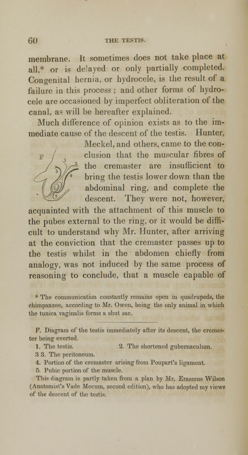 membrane. It sometimes does not take place at all,* or is delayed or only partially completed. Congenital hernia, or hydrocele, is the result of a failure in this process ; and other forms of hydro- cele are occasioned by imperfect obliteration of the canal, as will be hereafter explained. Much difference of opinion exists as to the im- mediate cause of the descent of the testis. Hunter, Meckel, and others, came to the con- clusion that the muscular fibres of the cremaster are insufficient to bring the testis lower down than the abdominal ring, and complete the descent. They were not, however, acquainted with the attachment of this muscle to the pubes external to the ring, or it would be diffi- cult to understand why Mr. Hunter, after arriving at the conviction that the cremaster passes up to the testis whilst in the abdomen chiefly from analogy, was not induced by the same process of reasoning to conclude, that a muscle capable of * The communication constantly remains open in quadrupeds, the chimpanzee, according to Mr. Owen, being the only animal in which the tunica vaginalis forms a shut sac. F. Diagram of the testis immediately after its descent, the cremas- ter being everted. 1. The testis. 2. The shortened gubernaculum. 3 3. The peritoneum. 4. Portion of the cremaster arising from Poupart's ligament. 5. Pubic portion of the muscle. This diagram is partly taken from a plan by Mr. Erasmus Wilson (Anatomist's Vade Mecum, second edition), who has adopted my viewB of the descent of the testis.