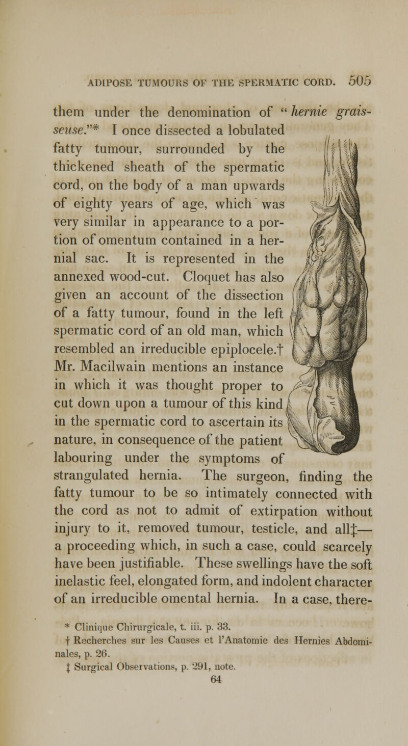 them under the denomination of  hernie grais- seuse* I once dissected a lobulated fatty tumour, surrounded by the thickened sheath of the spermatic cord, on the body of a man upwards of eighty years of age, which was very similar in appearance to a por- tion of omentum contained in a her- nial sac. It is represented in the annexed wood-cut. Cloquet has also given an account of the dissection of a fatty tumour, found in the left spermatic cord of an old man, which resembled an irreducible epiplocele.t Mr. Macilwain mentions an instance in which it was thought proper to cut down upon a tumour of this kind in the spermatic cord to ascertain its nature, in consequence of the patient labouring under the symptoms of strangulated hernia. The surgeon, finding the fatty tumour to be so intimately connected with the cord as not to admit of extirpation without injury to it, removed tumour, testicle, and all J— a proceeding which, in such a case, could scarcely have been justifiable. These swellings have the soft inelastic feel, elongated form, and indolent character of an irreducible omental hernia. In a case, there- * Cliniqne Chirunjicale, t. iii. p. 33. t Recherehes sur les Causes et l'Anatomie des Henries Abdomi- nales, p. 26. I Surgical Observations, p. 291, note. 64