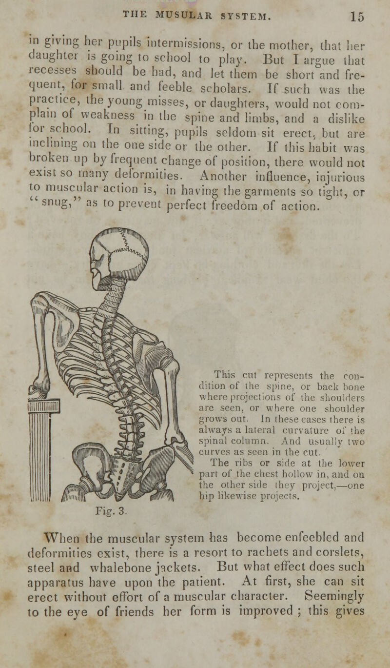 in giving her pupils intermissions, or the mother, that iier daughter is going to school to play. But I argue that recesses should be had, and let them be short and fre- quent, for small and feeble scholars. If such was the practice, the young misses, or daughters, would not com- plain of weakness in the spine and limbs, and a dislike for school. In sitting, pupils seldom sit erect, but are inclining on the one side or the other. If this habit was broken up by frequent change of position, there would not exist so many deformities. Another influence, injurious to muscular action is, in having the garments so tight, cr  snug, as to prevent perfect freedom of action. This cut represents the con- dition of the spine, or back bone where projections of the shoulders are seen, or where one shoulder grows out. In these cases there is always a lateral curvature of the spinal column. And usually two curves as seen in the cut, The ribs or side at the lower part of the chest hollow in, and on the other side ihey project.—one hip likewise projects. Fig. 3. When the muscular system has become enfeebled and deformities exist, there is a resort to rachets and corslets, steel and whalebone jackets. But what effect does such apparatus have upon the patient. At first, she can sit erect without effort of a muscular character. Seemingly to the eye of friends her form is improved ; this gives