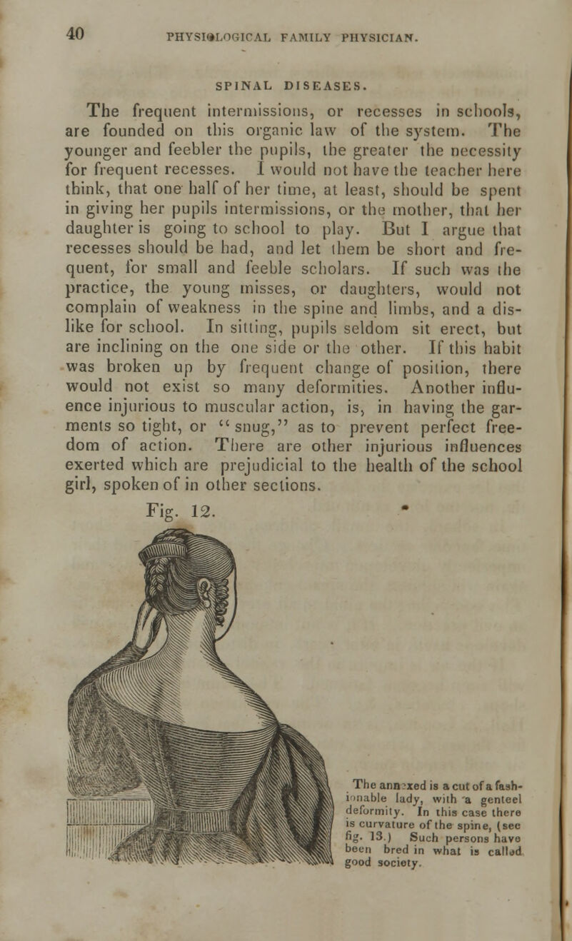SPINAL DISF.ASES. The frequent intermissions, or recesses in schools, are founded on this organic law of the system. The younger and feebler the pupils, the greater the necessity for frequent recesses. I would not have the teacher here think, that one half of her time, at least, should be spent in giving her pupils intermissions, or the mother, that her daughter is going to school to play. But I argue that recesses should he had, and let them be short and fre- quent, for small and feeble scholars. If such was the practice, the young misses, or daughters, would not complain of weakness in the spine and limbs, and a dis- like for school. In silting, pupils seldom sit erect, but are inclining on the one side or the other. If this habit was broken up by frequent change of position, there would not exist so many deformities. Another influ- ence injurious to muscular action, is, in having the gar- ments so tight, or snug, as to prevent perfect free- dom of action. There are other injurious influences exerted which are prejudicial to the health of the school girl, spoken of in other sections. Fig. 12. ■ The annexed is a cut of a fash- ionable lady, with 'a genteel deformity. In this case there is curvature of the spine, (see fig- 13.) Such persons have been bred in what is callod good society.