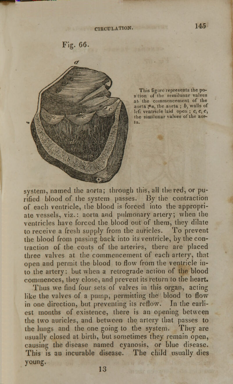 This fjgure represents the po- s lion of the semilunar valves at- the commencement of the aorta ;•«, the aorta ; b, walls of left ventricle laid open ; c, C, C, the similunar valves of the aon- la. system, named the aorta; through this, all the red, or pu- rified blood of the system passes. By the contraction of each ventricle, the blood is forced into the appropri- ate vessels, viz.: aorta and pulmonary artery; when the ventricles have forced the blood out of them, they dilate to receive a fresh supply from the auricles. To prevent the blood from passing back into its ventricle, by the con- traction of the coats of the arteries, there are placed three valves at the commencement of each artery, that open and permit the blood to flow from the ventricle in- to the artery: but when a retrograde action of the blood commences, they close, and prevent its return to the heart. Thus we find four sets of valves in this organ, acting like the valves of a pump, permitting the blood to flow in one direction, but preventing its reflow. In the earli- est months of existence, there is an opening between the two auricles, and between the artery that passes to the lungs and the one going to the system. They are usually closed at birth, but sometimes they remain open, causing the disease named cyanosis, or blue disease. This is an incurable disease. The child usually dies young. 13