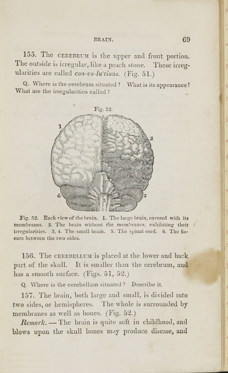 155. The cerebrum is the upper and front portion. The outside is irregular, like a peach stone. These irreg- ularities are called con-vo-lu'tions. (Fig. 51.) Q. Where is the cerebrum situated ? What is its appearance 1 What are the irregularities called ? Fig. 52. Fig. r>2. Back view of the brain. 1. The large brain, covered with its membranes. 2. The brain without the membranes, exhibiting their irregularities. 3, 4. The small brain. 5. The spinal cord. 6. The fis- sure between the two sides. 156. The cerebellum is placed at the lower and back part of the skull. It is smaller than the cerebrum, and has a smooth surface. (Figs. 51, 52.) Q. Where is the cerebellum situated ? Describe it. 157. The brain, both large and small, is divided into two sides, or hemispheres. The whole is surrounded by membranes as well as bones. (Fig. 52.) Remark.—The brain is quite soft in childhood, and blows upon the skull bones may produce disease, and