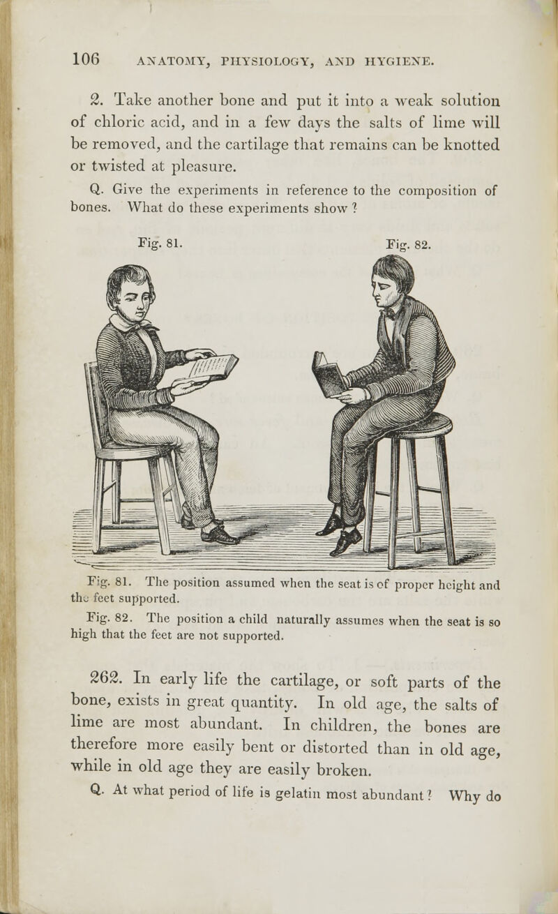 2. Take another bone and put it into a weak solution of chloric acid, and in a few days the salts of lime will be removed, and the cartilage that remains can be knotted or twisted at pleasure. Q. Give the experiments in reference to the composition of bones. What do these experiments show ? Fig. 81 Fi<r. 82. Fig. 81. The position assumed when the seat is of proper height and th;j feet supported. Fig. 82. The position a child naturally assumes when the seat is so high that the feet are not supported. 262. In early life the cartilage, or soft parts of the bone, exists in great quantity. In old age, the salts of lime are most abundant. In children, the bones are therefore more easily bent or distorted than in old age, while in old age they are easily broken. Q. At what period of life is gelatin most abundant I Why do