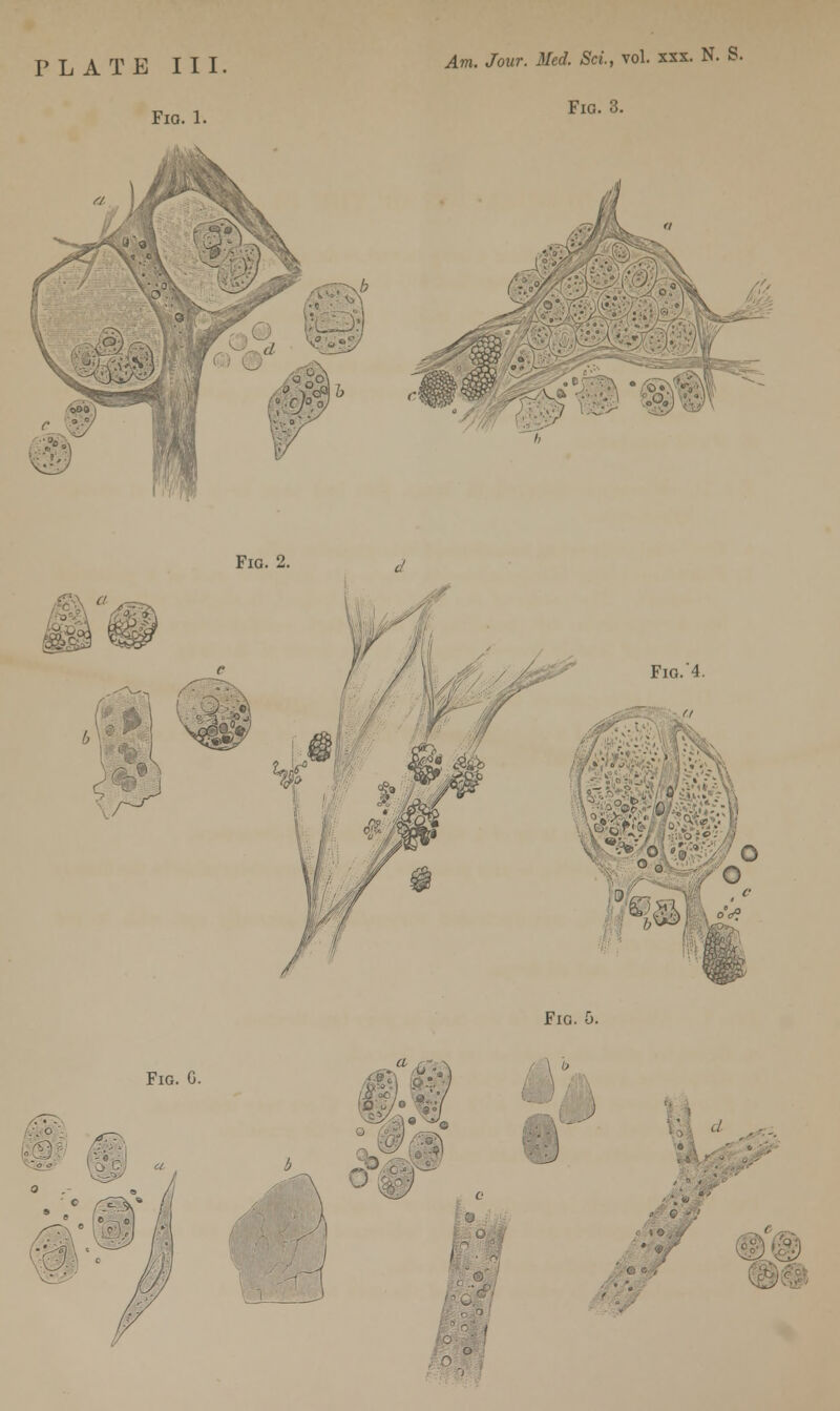 PLATE III. Fig. 1. Am. Jour. Med. ScL, vol. xsx. N. S. Fig. 3. V'i ''■' o*l 7« Fig. 2 ISO'S W Fio.'4. . ■ ■ o 0, & S i ', oc°. Fig. 5. Fig. G. ' &P.7 ,-.