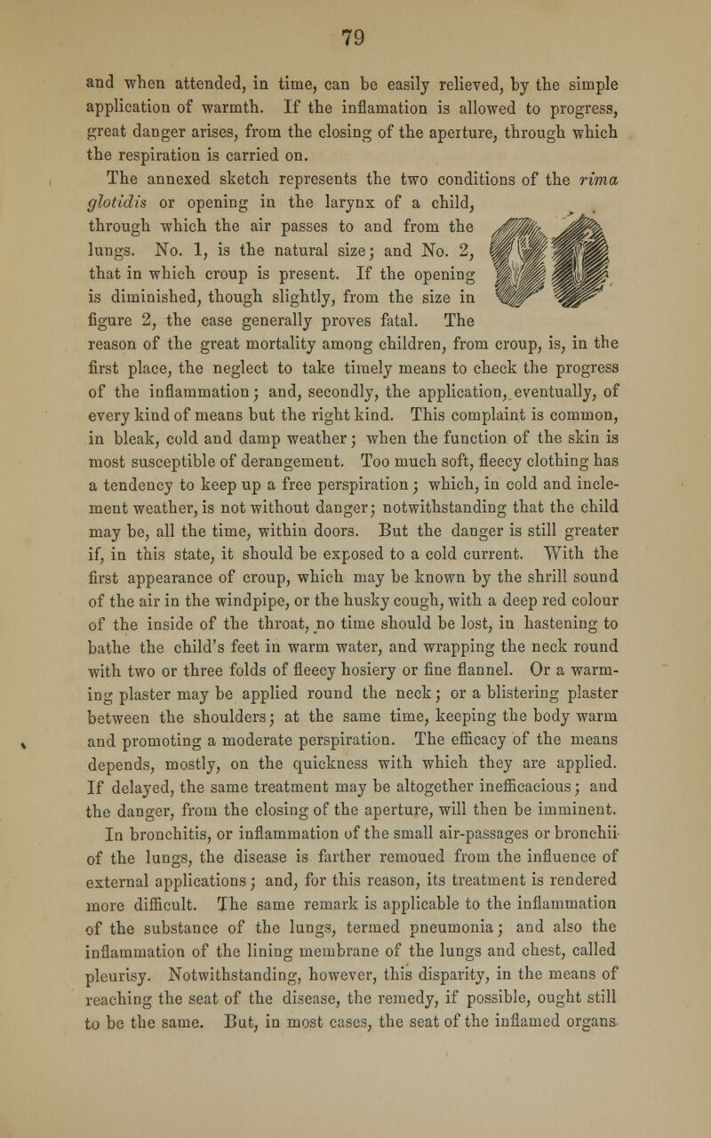 and when attended, in time, can be easily relieved, by the simple application of warmth. If the inflamation is allowed to progress, great danger arises, from the closing of the aperture, through which the respiration is carried on. The annexed sketch represents the two conditions of the rima glotidis or opening in the larynx of a child, through which the air passes to and from the /^Mfafr J0^p lungs. No. 1, is the natural size; and No. 2, that in which croup is present. If the opening is diminished, though slightly, from the size in figure 2, the case generally proves fatal. The reason of the great mortality among children, from croup, is, in the first place, the neglect to take timely means to check the progress of the inflammation; and, secondly, the application, eventually, of every kind of means but the right kind. This complaint is common, in bleak, cold and damp weather; when the function of the skin is most susceptible of derangement. Too much soft, fleecy clothing has a tendency to keep up a free perspiration ; which, in cold and incle- ment weather, is not without danger; notwithstanding that the child may be, all the time, within doors. But the danger is still greater if, in this state, it should be exposed to a cold current. With the first appearance of croup, which may be known by the shrill sound of the air in the windpipe, or the husky cough, with a deep red colour of the inside of the throat, no time should be lost, in hastening to bathe the child's feet in warm water, and wrapping the neck round with two or three folds of fleecy hosiery or fine flannel. Or a warm- ing plaster may be applied round the neck; or a blistering plaster between the shoulders; at the same time, keeping the body warm and promoting a moderate perspiration. The efficacy of the means depends, mostly, on the quickness with which they are applied. If delayed, the same treatment may be altogether inefficacious; and the danger, from the closing of the aperture, will then be imminent. In bronchitis, or inflammation of the small air-passages or bronchii- of the lungs, the disease is farther remoued from the influence of external applications; and, for this reason, its treatment is rendered more difficult. The same remark is applicable to the inflammation of the substance of the lungs, termed pneumonia; and also the inflammation of the lining membrane of the lungs and chest, called pleurisy. Notwithstanding, however, this disparity, in the means of reaching the seat of the disease, the remedy, if possible, ought still to be the same. But, in most cases, the seat of the inflamed organs