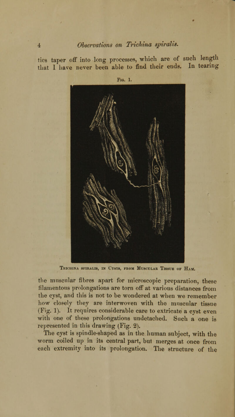 ties taper off into long processes, which are of such length that I have never been able to find their ends. In tearing Fig. 1. Tbicuina spiralis, in Cysts, from Muscular Tissue of Ham. the muscular fibres apart for microscopic preparation, these filamentous prolongations are torn off at various distances from the cyst, and this is not to be wondered at when we remember how closely they are interwoven with the muscular tissue (Fig. 1). It requires considerable care to extricate a cyst even with one of these prolongations undetached. Such a one is represented in this drawing (Fig. 2). The cyst is spindle-shaped as in the human subject, with the worm coiled up in its central part, but merges at once from each extremity into its prolongation. The structure of the