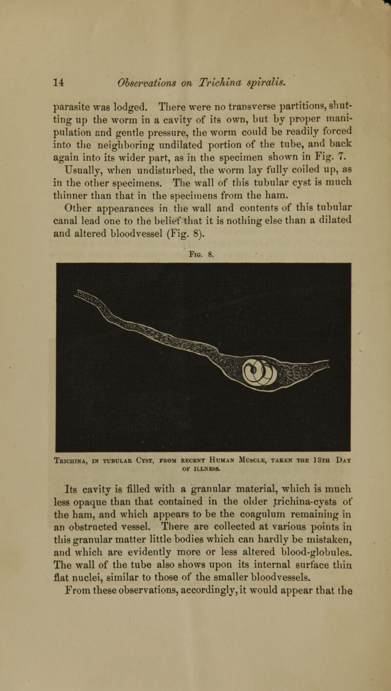 parasite was lodged. There were no transverse partitions, shut- ting up the worm in a cavity of its own, but by proper mani- pulation and gentle pressure, the worm could be readily forced into the neighboring nndilated portion of the tube, and back again into its wider part, as in the specimen shown in Fig. 7. Usually, when undisturbed, the worm lay fully coiled up, as in the other specimens. The wall of this tubular cyst is much thinner than that in the specimens from the ham. Other appearances in the wall and contents of this tubular canal lead one to the belief that it is nothing else than a dilated and altered bloodvessel (Fig. 8). Fig. 8. Trichina, in tubular Ctst, from recent Human Muscle, taken the 13th Day of illness. Its cavity is filled with a granular material, which is much less opaque than that contained in the older trichina-cysts of the ham, and which appears to be the coagulum remaining in an obstructed vessel. There are collected at various points in this granular matter little bodies which can hardly be mistaken, and which are evidently more or less altered blood-globules. The wall of the tube also shows upon its internal surface thin flat nuclei, similar to those of the smaller bloodvessels. From these observations, accordingly, it would appear that the