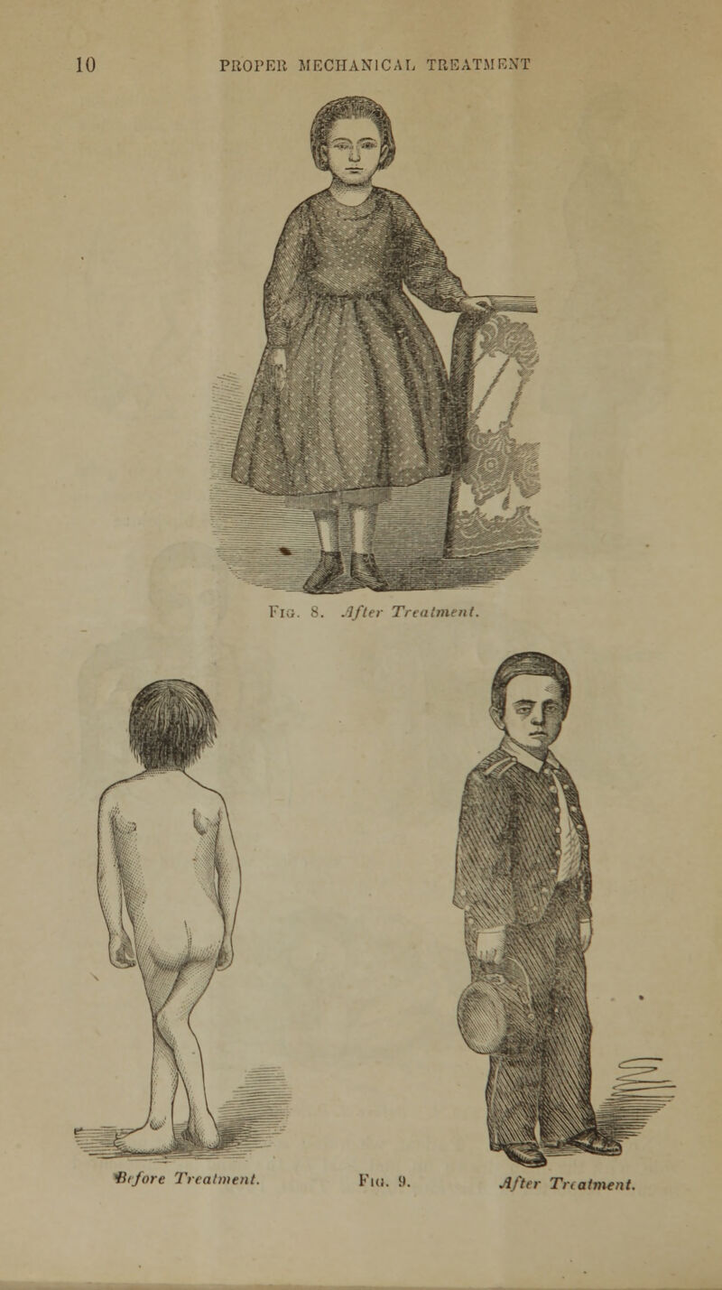 Fio. 8. After Treatment. Htfore Treatment. Fio. 9. After Tnatment.