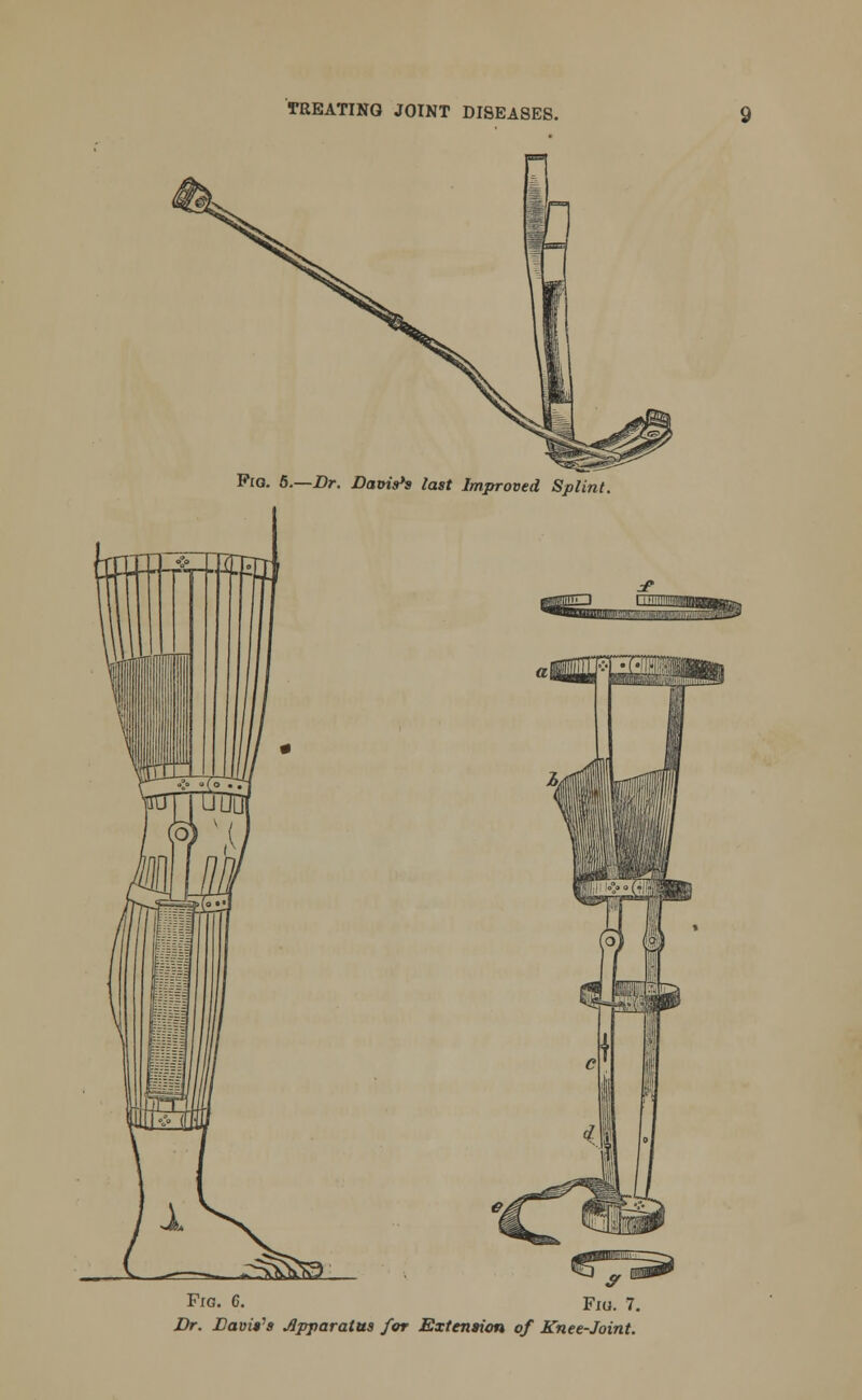 Pig. 5.—Dr. Dat>is*s last Improved Splint. Fig. 6. Dr. Davit's Apparatus for Extension of Knee-Joint.