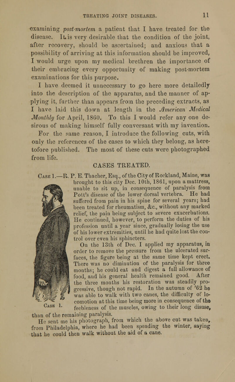 examining 'postmortem a patient that I have treated for the disease. It.is very desirable that the condition of the joint, after recovery, should be ascertained; and anxious that a possibility of arriving at this information should be improved, I would urge upon my medical brethren the importance of their embraciug every opportunity of making post-mortem examinations for this purpose. I have deemed it unnecessary to go here more detailedly into the description of the apparatus, and the manner of ap- plying it, further than appears from the preceding extracts, as I have laid this down at length in the American Medical Monthly for April, 1860. To this I would refer any one de- sirous of making himself fully conversant with my invention. For the same reason, I introduce the following cuts, with only the references of the cases to which they belong, as here- tofore published. The most of these cuts were photographed from life. CASES TREATED. Case 1.—R. P. E. Thacher, Esq., of the City of Rockland, Maine, was brought to this city Dec. 10th, 1861, upon a mattress, unable to sit up, in consequence of paralysis from Pott's disease of the lower dorsal vertebra. He had suffered from pain in his spine for several years; had been treated for rheumatism, &c, without any marked relief, the pain beiug subject to severe exacerbations. He continued, however, to perform the duties of his profession until a year since, gradually losing the use of his lower extremities, until he had quite lost the con- trol over even his sphincters. On the 13th of Dec. I applied my apparatus, in order to remove the pressure from the ulcerated sur- faces, the figure being at the same time kept erect. There was no diminution of the paralysis for three months; he could eat and digest a full allowance of food, aud his general health remained good. After the three months his restoration was steadily pro- gressive, though not rapid. In the autumn of '62 he was able to walk with two canes, the difficulty of lo- comotion at this time being more in consequence of the feebleness of the muscles, owing to their long disuse, than of the remaining paralysis. Ho sent me his photograph, from which the above cut was taken, from Philadelphia, where he had been spending the winter, saying that he could then walk without the aid of a cane.