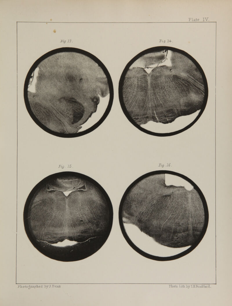 Plate IV, Yh oto p:soph e <i byJ.D p,au Tlioto Lift iy IB .Bradford