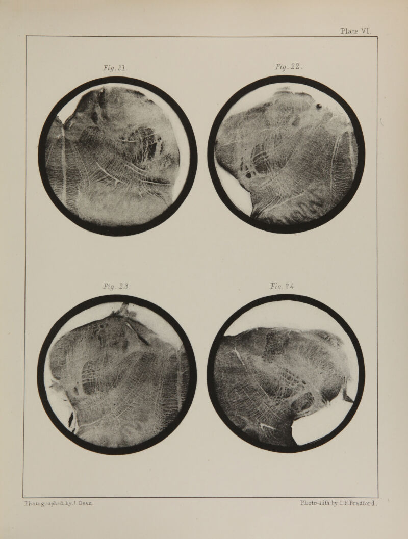 Fig. 21 Iiq. 23, Tuj.22 Jin. 24 Pto tt i g1 r aph e 1 Ly. F. H e a.n.. ?}ioto-Litli..by I HSradfor (L.
