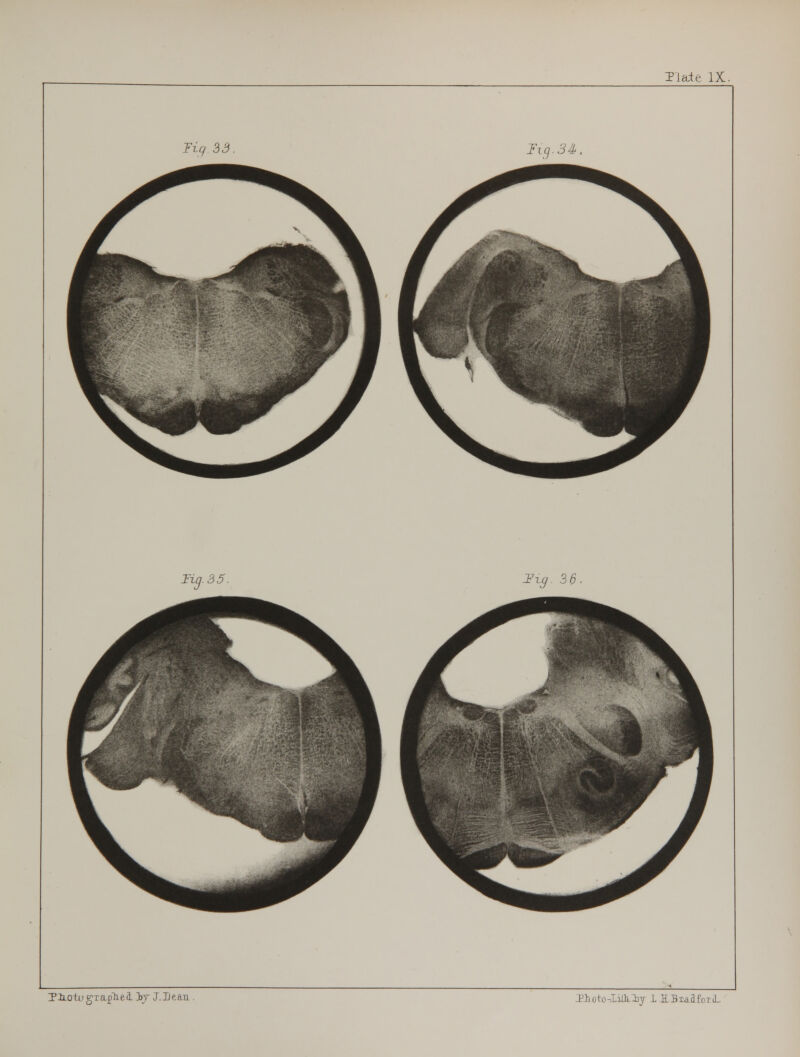 Tledt IX. TlLOtti g-rapliei Ij J. lie an Tioto-IiOLly lUBiaaiMl