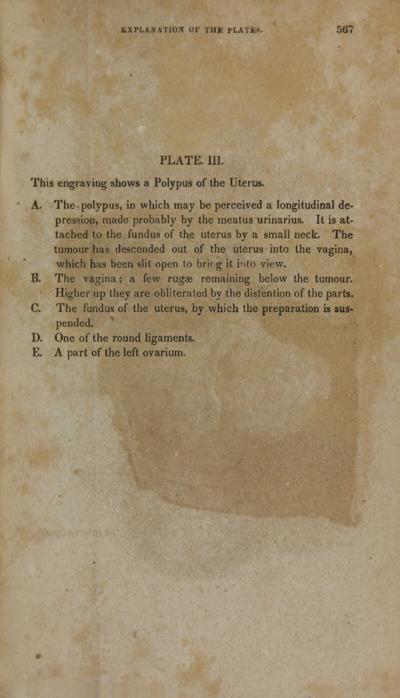 PLATE. III. This engraving shows a Polypus of the Uterus. A. The polypus, in which may be perceived a longitudinal de- pression, made probably by the meatus urinarius. It is at- tached to the fundus of the uterus by a small neck. The tumour has descended out of the uterus into the vagina, which has been slit open to brit g it into view. B. The vagina; a few ruga? remaining below the tumour. Higher up they are obliterated by the distention of the parts. C. The fundus of the uterus, by which the preparation is sus- pended. D. One of the round ligaments. E. A part of the left ovarium.