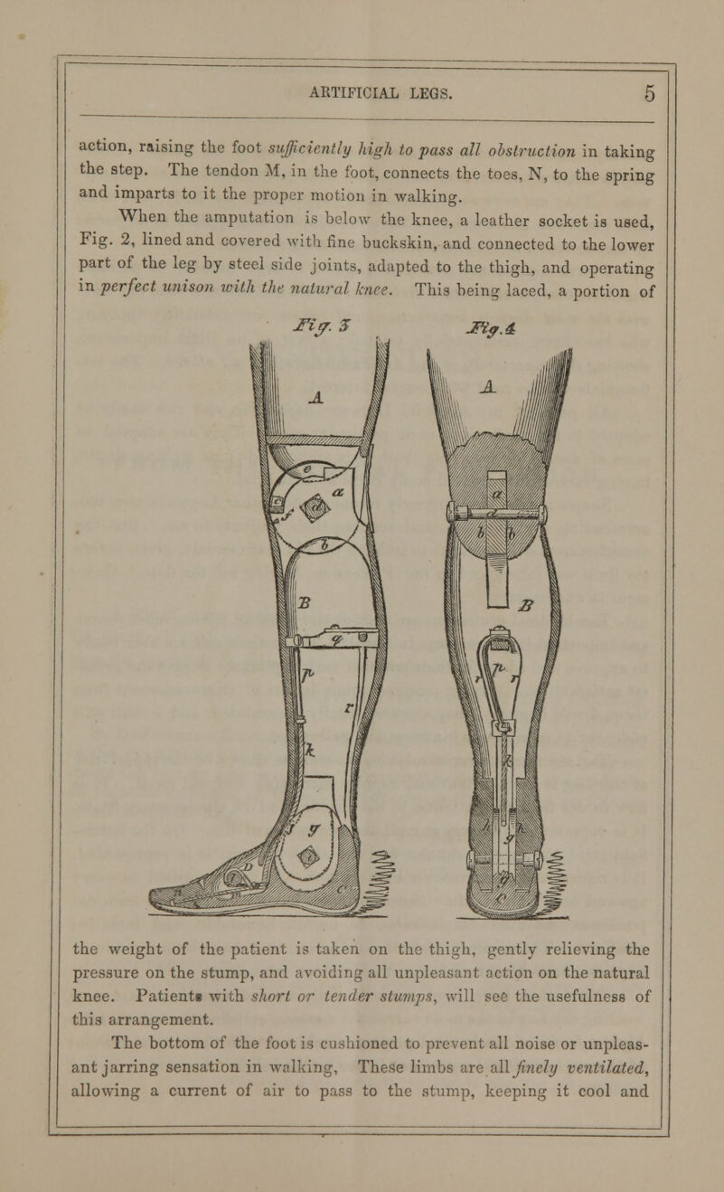 action, raising the foot sufficiently high to pass all obstruction in taking the step. The tendon M, in the foot, connects the toes, N, to the spring and imparts to it the proper motion in walking. When the amputation is below the knee, a leather socket is used, Fig. 2, lined and covered with fine buckskin, and connected to the lower part of the leg by steel side joints, adapted to the thigh, and operating in perfect unison with the natural hire. This being laced, a portion of Tip. J Jty.4 the weight of the patient is taken on the thigh, gently relieving the pressure on the stump, and avoiding all unpleasant action on the natural knee. Patientt with short or tender stumps, will see the usefulness of this arrangement. The bottom of the foot is cushioned to prevent all noise or unpleas- ant jarring sensation in walking, These limbs are all finely ventilated, allowing a current of air to pass to the stump, keeping it cool and