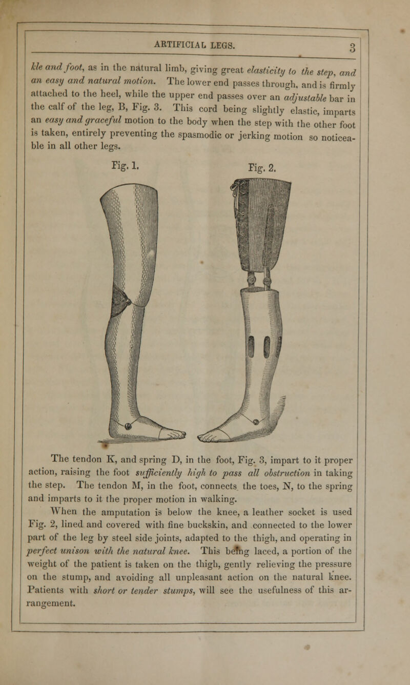 Me and foot, as in the natural limb, giving great elasticity to the step, and an easy and natural motion. The lower end passes through, and is firmly attached to the heel, while the upper end passes over an adjustable bar in the calf of the leg, B, Fig. 3. This cord being slightly elastic, imparts an easy and graceful motion to the body when the step with the other foot is taken, entirely preventing the spasmodic or jerking motion so noticea- ble in all other legs. rig. 1. Pig. 2. The tendon K, and spring D, in the foot, Fig. 3, impart to it proper action, raising the foot sufficiently high to pass all obstruction in taking the step. The tendon M, in the foot, connects the toes, N, to the spring and imparts to it the proper motion in walking. A\ hen the amputation is below the knee, a leather socket is used Fig. 2, lined and covered with fine buckskin, and connected to the lower part of the leg by steel side joints, adapted to the thigh, and operating in perfect unison with the natural knee. This belhg laced, a portion of the weight of the patient is taken on the thigh, gently relieving the pressure on the stump, and avoiding all unpleasant action on the natural knee. Patients with short or tender stumps, will see the usefulness of this ar- rangement.