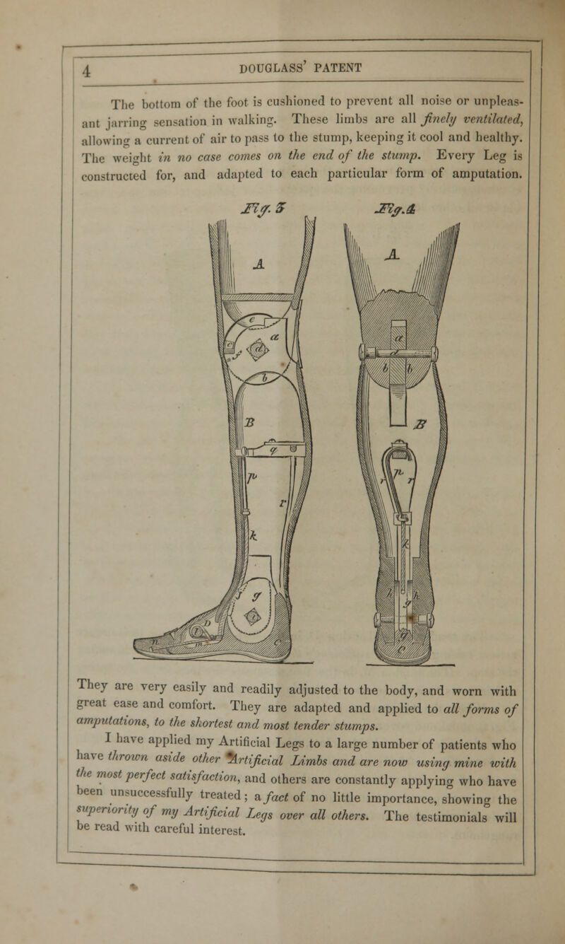 The bottom of the foot is cushioned to prevent all noise or unpleas- ant jarring sensation in walking. These limbs are all finely ventilated, allowing a current of air to pass to the stump, keeping it cool and healthy. The weight in no case comes on the end of the stump. Every Leg is constructed for, and adapted to each particular form of amputation. Mf. Z JFi<?.4i They are very easily and readily adjusted to the body, and worn with great ease and comfort. They are adapted and applied to all forms of amputations, to the shortest and most tender stumps. I have applied my Artificial Legs to a large number of patients who have thrown aside other Artificial Limbs and are now using mine with the most perfect satisfaction, and others are constantly applying who have been unsuccessfully treated; 2, fact of no little importance, showing the superior^ of my Artificial Legs over all others. The testimonials will be read with careful interest.
