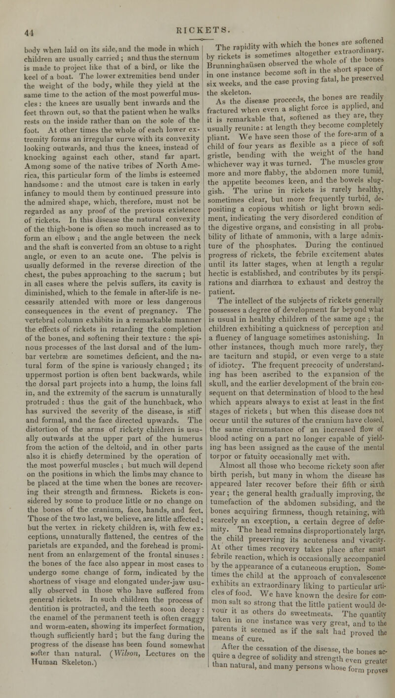 41 body when laid on its side, and the mode in which children are usually carried ; and thus the sternum is made to project like that of a bird, or like the keel of a boat. The lower extremities bend under the weight of the body, while they yield at the same time to the action of the most powerful mus- cles : the knees are usually bent inwards and the feet thrown out, so that the patient when he walks rests on the inside rather than on the sole of the foot. At other times the whole of each lower ex- tremity forms an irregular curve with its convexity looking outwards, and thus the knees, instead of knocking against each other, stand far apart. Among some of the native tribes of North Ame- rica, this particular form of the limbs is esteemed handsome: and the utmost care is taken in early infancy to mould them by continued pressure into the admired shape, which, therefore, must not be regarded as any proof of the previous existence of rickets. In this disease the natural convexity of the thigh-bone is often so much increased as to form an elbow ; and the angle between the neck and the shaft is converted from an obtuse to a right angle, or even to an acute one. The pelvis is usually deformed in the reverse direction of the chest, the pubes approaching to the sacrum; but in all cases where the pelvis suffers, its cavity is diminished, which to the female in after-life is ne- cessarily attended with more or less dangerous consequences in the event of pregnancy. The vertebral column exhibits in a remarkable manner the effects of rickets in retarding the completion of the bones, and softening their texture : the spi- nous processes of the last dorsal and of the lum- bar vertebra? are sometimes deficient, and the na- tural form of the spine is variously changed; its uppermost portion is often bent backwards, while the dorsal part projects into a hump, the loins fall in, and the extremity of the sacrum is unnaturally protruded : thus the gait of the hunchback, who has survived the severity of the disease, is stiff and formal, and the face directed upwards. The distortion of the arms of rickety children is usu- ally outwards at the upper part of the humerus from the action of the deltoid, and in other parts also it is chiefly determined by the operation of the most powerful muscles ; but much will depend on the positions in which the limbs may chance to be placed at the time when the bones are recover- ing their strength and firmness. Rickets is con- sidered by some to produce little or no change on the bones of the cranium, face, hands, and feet. Those of the two last, we believe, are little affected ; but the vertex in rickety children is, with few ex- ceptions, unnaturally flattened, the centres of the parietals are expanded, and the forehead is promi- nent from an enlargement of the frontal sinuses : the bones of the face also appear in most cases to undergo some change of form, indicated by the shortness of visage and elongated under-jaw usu- ally observed in those who have suffered from general rickets. In such children the process of dentition is protracted, and the teeth soon decay : the enamel of the permanent teeth is often craggy and worm-eaten, showing its imperfect formation, though sufficiently hard; but the fang during the progress of the disease has been found somewhat softer than natural. (Wihon, Lectures on the Human Skeleton.) rapidity with which the bones are softened etimes altogether extraord observed the whole of the by S'^methnes altogether e,,^ Brunn.nghausen observed the wW^thjtanj b one instance become soft in the bort space of six weeks, and the case proving fatal, he presened the skeleton. , ,-, As the disease proceeds, the bones are readily fractured when even a slight force ,s applied and it is remarkable that, softened as they are they usually reunite: at length they become completely pliant. We have seen those of the fore-arm of a child of four years as flexible as a piece of soft gristle, bending with the weight of the hand whichever way it was turned. The muscles grow- more and more flabby, the abdomen more tumid, the appetite becomes keen, and the bowels slug- gish. The urine in rickets is rarely healthy, sometimes clear, but more frequently turbid, de- positing a copious whitish or light brown sedi- ment, indicating the very disordered condition of the digestive organs, and consisting in all proba- bility of lithate of ammonia, with a large admix- ture of the phosphates. During the continued progress of rickets, the febrile excitement abates until its latter stages, when at length a regular hectic is established, and contributes by its perspi- rations and diarrhoea to exhaust and destroy the patient. The intellect of the subjects of rickets generally possesses a degree of development far beyond what is usual in healthy children of the same age ; the children exhibiting a quickness of perception and a fluency of language sometimes astonishing. In other instances, though much more rarely, they are taciturn and stupid, or even verge to a state ofidiotcy. The frequent precocity of understand- ing has been ascribed to the expansion of the skull, and the earlier development of the brain con- sequent on that determination of blood to the head which appears always to exist at least in the first stages of rickets ; but when this disease does not occur until the sutures of the cranium have closed, the same circumstance of an increased flow of blood acting on a part no longer capable of yield- ing has been assigned as the cause of the mental torpor or fatuity occasionally met with. Almost all those who become rickety soon after birth perish, but many in whom the disease has appeared later recover before their fifth or sixth year; the general health gradually improving, the tumefaction of the abdomen subsiding, and the bones acquiring firmness, though retaining, with scarcely an exception, a certain degree of defor- mity. The head remains disproportionately large, the child preserving its acuteness and vivacity. At other times recovery takes place after smart febrile reaction, which is occasionally accompanied by the appearance of a cutaneous eruption. Some- times the child at the approach of convalescence exhibits an extraordinary liking to particular arti- cles of food. We have known the desire for com- mon salt so strong that the little patient would de- vour it as others do sweetmeats. The quantitv taken m one instance was very great, and to the parents it seemed as if the salt had proved the means of cure. After the cessation of the disease, the bones ac- quire a degree of solidity and strength even greater than natural, and many persons whose form proves