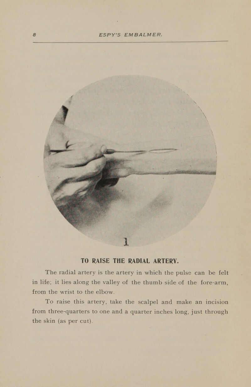 TO RAISE THE RADIAL ARTERY. The radial artery is the artery in which the pulse can be felt in life; it lies along the valley of the thumb side of the fore-arm, from the wrist to the elbow. To raise this artery, take the scalpel and make an incision from three-quarters to one and a quarter inches long, just through the skin (as per cut).