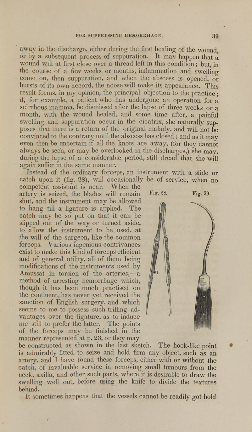28. Fig. 29. away in the discharge, either during the first healing of the wound, or by a subsequent process of suppuration. It may happen that a wound will at first close over a thread left in this condition; but, in the course of a few weeks or months, inflammation and swelling come on, then suppuration, and when the abscess is opened, or bursts of its own accord, the noose will make its appearance. This result forms, in my opinion, the principal objection to the practice; if, for example, a patient who has undergone an operation for a scirrhous mamma, be dismissed after the lapse of three weeks or a month, with the wound healed, and some time after, a painful swelling and suppuration occur in the cicatrix, she naturally sup- poses that there is a return of the original malady, and will not be convinced to the contrary until the abscess has closed; and as it may even then be uncertain if all the knots are away, (for they cannot always be seen, or may be overlooked in the discharges,) she may, during the lapse of a considerable period, still dread that she will again suffer in the same manner. Instead of the ordinary forceps, an instrument with a slide or catch upon it (fig. 28), will occasionally be of service, when no competent assistant is near. When the artery is seized, the blades will remain shut, and the instrument may be allowed to hang till a ligature is applied. The catch may be so put on that it can be slipped out of the way or turned aside, to allow the instrument to be used, at the will of the surgeon, like the common forceps. Various ingenious contrivances exist to make this kind of forceps efficient and of general utility, all of them being modifications of the instruments used by Amussat in torsion of the arteries,—a method of arresting hemorrhage which, though it has been much practised on the continent, has never yet received the sanction of English surgery, and which seems to me to possess such trifling ad- vantages over the ligature, as to induce me still to prefer the latter. The points of the forceps may be finished in the manner represented at p. 23, or they may be constructed as shown in the last sketch. The hook-like point is admirably fitted to seize and hold firm any object, such as an artery, and I have found these forceps, either with or without the catch, of invaluable service in removing small tumours from the neck, axilla, and other such parts, where it is desirable to draw the swelling well out, before using the knife to divide the textures behind. It sometimes happens that the vessels cannot be readily got hold