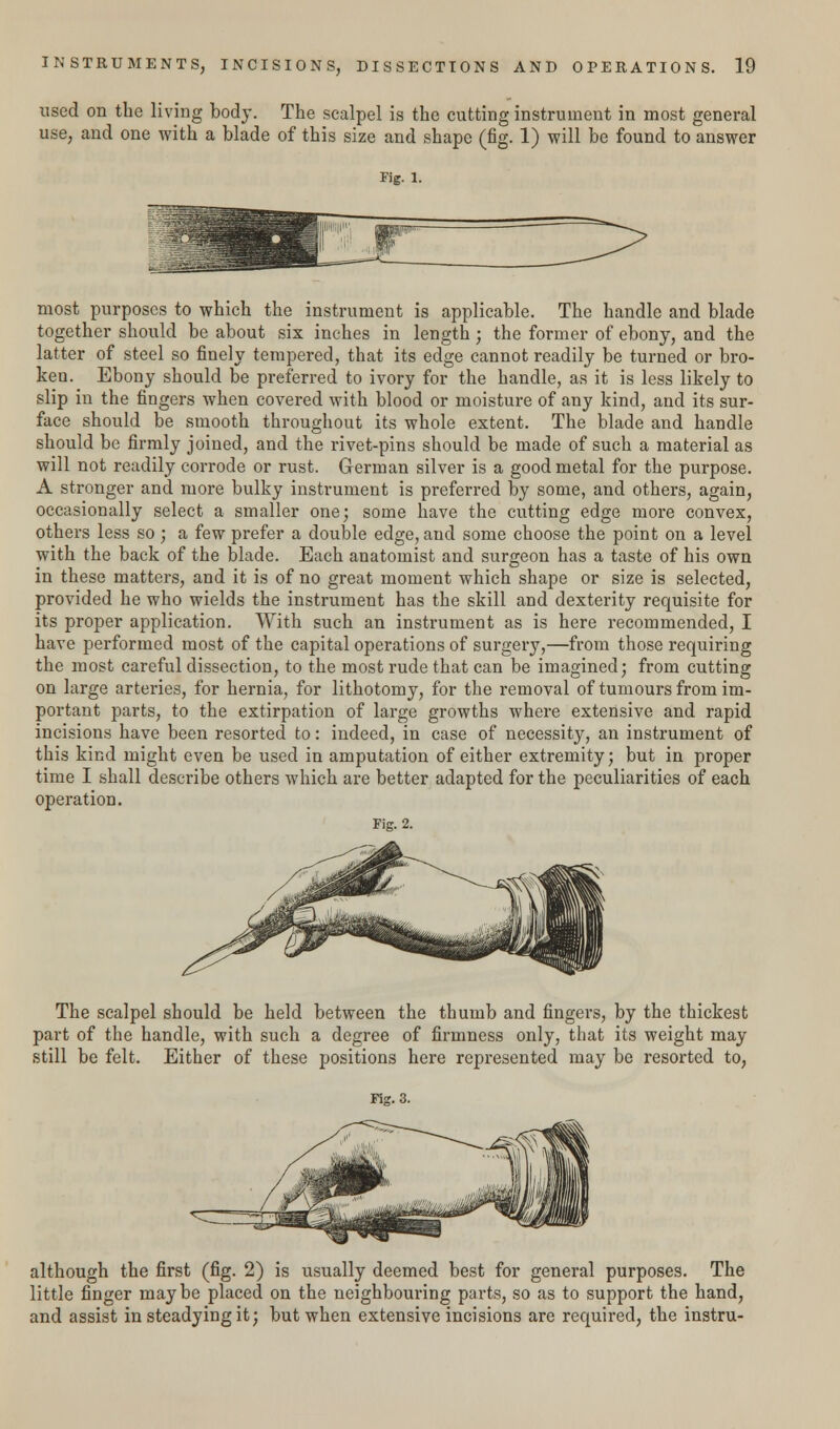used on the living body. The scalpel is the cutting instrument in most general use, and one with a blade of this size and shape (fig. 1) will be found to answer Fig. l. most purposes to which the instrument is applicable. The handle and blade together should be about six inches in length; the former of ebony, and the latter of steel so finely tempered, that its edge cannot readily be turned or bro- ken. Ebony should be preferred to ivory for the handle, as it is less likely to slip in the fingers when covered with blood or moisture of any kind, and its sur- face should be smooth throughout its whole extent. The blade and handle should be firmly joined, and the rivet-pins should be made of such a material as will not readily corrode or rust. German silver is a good metal for the purpose. A stronger and more bulky instrument is preferred by some, and others, again, occasionally select a smaller one; some have the cutting edge more convex, others less so ; a few prefer a double edge, and some choose the point on a level with the back of the blade. Each anatomist and surgeon has a taste of his own in these matters, and it is of no great moment which shape or size is selected, provided he who wields the instrument has the skill and dexterity requisite for its proper application. With such an instrument as is here recommended, I have performed most of the capital operations of surgery,—from those requiring the most careful dissection, to the most rude that can be imagined; from cutting on large arteries, for hernia, for lithotomy, for the removal of tumours from im- portant parts, to the extirpation of large growths where extensive and rapid incisions have been resorted to: indeed, in case of necessity, an instrument of this kind might even be used in amputation of either extremity; but in proper time I shall describe others which are better adapted for the peculiarities of each operation. Fig. 2. The scalpel should be held between the thumb and fingers, by the thickest part of the handle, with such a degree of firmness only, that its weight may still be felt. Either of these positions here represented may be resorted to, Fig. 3. although the first (fig. 2) is usually deemed best for general purposes. The little finger maybe placed on the neighbouring parts, so as to support the hand, and assist in steadying it; but when extensive incisions are required, the instru-