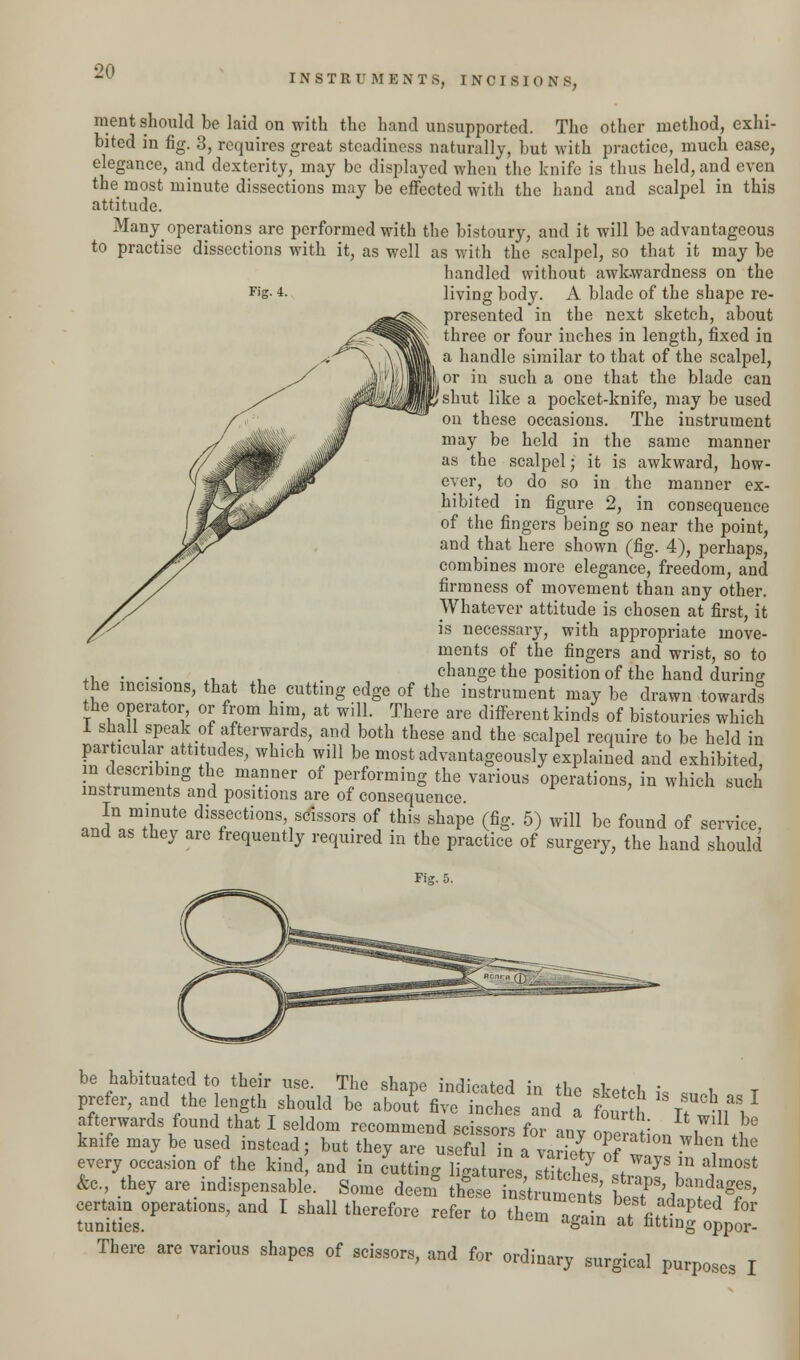 INSTRUMENTS, INCISIONS, ment should be laid on with the hand unsupported. The other method, exhi- bited in fig. 3, requires great steadiness naturally, but with practice, much ease, elegance, and dexterity, may be displayed when the knife is thus held, and even the most minute dissections may be effected with the hand and scalpel in this attitude. Many operations are performed with the bistoury, and it will be advantageous to practise dissections with it, as well as with the scalpel, so that it may be handled without awkwardness on the living body. A blade of the shape re- presented in the next sketch, about three or four inches in length, fixed in a handle similar to that of the scalpel, ,or in such a one that the blade can 'shut like a pocket-knife, may be used on these occasions. The instrument may be held in the same manner as the scalpel; it is awkward, how- ever, to do so in the manner ex- hibited in figure 2, in consequence of the fingers being so near the point, and that here shown (fig. 4), perhaps, combines more elegance, freedom, and firmness of movement than any other. Whatever attitude is chosen at first, it is necessary, with appropriate move- ments of the fingers and wrist, so to ,, . . . x. , change the position of the hand during he incisions, that the cutting edge of the instrument may be drawn towards the operator, or from him, at will. There are different kinds of bistouries which I shall speak of afterwards, and both these and the scalpel require to be held in particular attitudes, which will be most advantageously explained and exhibited, in describing the manner of performing the various operations, in which such instruments and positions are of consequence. «Jn,fTte di7ctions> sclssors of this shape (fig. 5) will be found of service, and as they are frequently required in the practice of surgery, the hand should Fig. 5. be habituated to their use. The shape indicated in th- DW i • , prefer, and the length should be abou't five inct8 and J £S V^ afterwards found that I seldom recommend scissors for any onefation 1 ^ knife may be used instead; but they are useful in a variety Sf I • ? the every occasion of the kind, and in cutting ligatms 2, * y8,m alm°St &c, they are indispensable. Some deem these™strumP„f' f?8'bandaS^> certain operations, and I shall therefore refeto them aS^ affitl^ ^ tunities. &am at nttmg oppor- There are various shapes of scissors, and for ordinary surgical purposes I