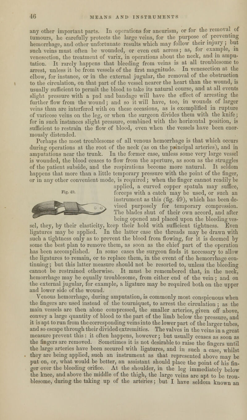 any other important parts. In operations for aneurism, or for the removal of tumours, he carefully protects the large veins, for the purpose of preventing hemorrhage, and other unfortunate results which may follow their injury ; but such veins must often be wounded, or even cut across; as, for example, in venesection, the treatment of varix, in operations about the neck, and in ampu- tation. It rarely happens that bleeding from veins is at all troublesome to arrest, unless it be from vessels of the first magnitude. In venesection at the elbow, for instance, or in the external jugular, the removal of the obstruction to the circulation, on that part of the vessel nearer the heart than the wound, is usually sufficient to permit the blood to take its natural course, and at all events slight pressure with a pad and bandage will have the effect of arresting the further flow from the wound; and so it will have, too, in wounds of larger veins than are interfered with on these occasions, as is exemplified in rupture of varicose veins on the leg, or when the surgeon divides them with the knife; for in such instances slight pressure, combined with the horizontal position, is sufiicient to restrain the flow of blood, even when the vessels have been enor- mously distended. Perhaps the most troublesome of all venous hemorrhage is that which occurs during operations at the root of the neck (as on the principal arteries), and in amputations near the trunk. In the former case, unless some very large vessel is wounded, the blood ceases to flow from the aperture, as soon as the struggles of the patient subside, and the respirations become more natural. It seldom happens that more than a little temporary pressure with the point of the finger, or in any other convenient mode, is required; when the finger cannot readily be applied, a curved copper spatula may suffice, Fis- 49- forceps with a catch may be used, or such an instrument as this (fig. 49), which has been de- vised purposely for temporary compression. The blades shut of their own accord, and after being opened and placed upon the bleeding ves- sel, they, by their elasticity, keep their hold with sufficient tightness. Even ligatures may be applied. In the latter case the threads may be drawn with such a tightness only as to prevent the blood from flowing, for it is deemed by some the best plan to remove them, as soon as the chief part of the operation has been accomplished. In some cases the surgeon finds it necessary to allow the ligatures to remain, or to replace them, in the event of the hemorrhage con- tinuing; but this latter measure should not be resorted to, unless the bleeding cannot be restrained otherwise. It must be remembered that, in the neck, hemorrhage may be equally troublesome, from either end of the vein; and on the external jugular, for example, a ligature may be required both on the upper and lower side of the wound. Venous hemorrhage, during amputation, is commonly most conspicuous when the fingers are used instead of the tourniquet, to arrest the circulation : as the main vessels are then alone compressed, the smaller arteries, given off above, convey a large quantity of blood to the part of the limb below the pressure, and it is apt to run from the corresponding veins into the lower part of the larger tubes and so escape through their divided extremities. The valves in the veins in a great measure prevent this : it often happens, however; but usually ceases as soon as the fingers are removed. Sometimes it is not desirable to raise the fingers until the large arteries have been secured with ligatures, and in such a case whilst they are being applied, such an instrument as that represented above may be put on, or, what would be better, an assistant should place the point of his fin- ger over the bleeding orifice. At the shoulder, in the leg immediately below the knee, and above the middle of the thigh, the large veins are apt to be trou- blesome, during the taking up of the arteries; but I have seldom known an
