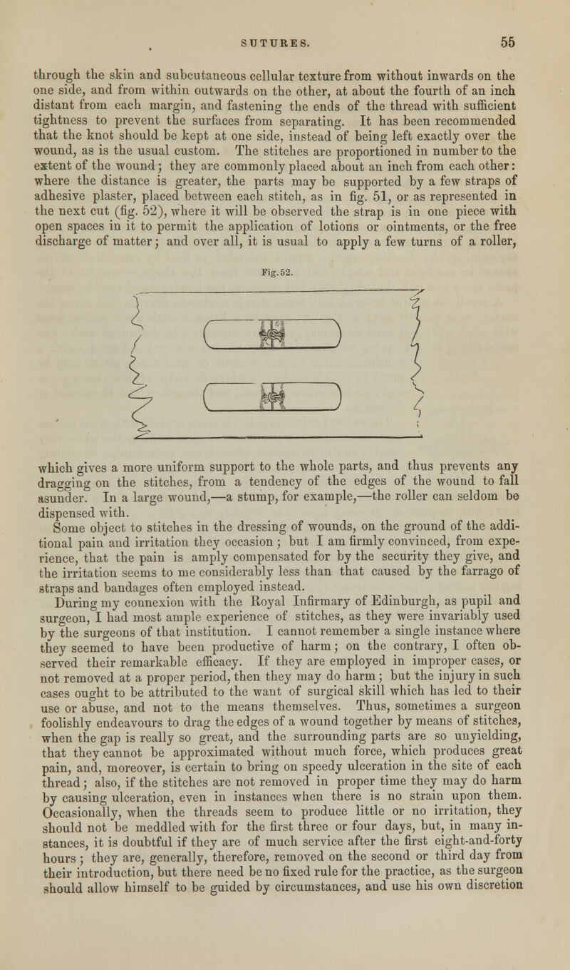 through the skin and subcutaneous cellular texture from without inwards on the one side, and from within outwards on the other, at about the fourth of an inch distant from each margin, and fastening the ends of the thread with sufficient tightness to prevent the surfaces from separating. It has been recommended that the knot should be kept at one side, instead of being left exactly over the wound, as is the usual custom. The stitches are proportioned in number to the extent of the wound; they are commonly placed about an inch from each other: where the distance is greater, the parts may be supported by a few straps of adhesive plaster, placed between each stitch, as in fig. 51, or as represented in the next cut (fig. 52), where it will be observed the strap is in one piece with open spaces in it to permit the application of lotions or ointments, or the free discharge of matter; and over all, it is usual to apply a few turns of a roller, Fig.52. — ^ c ( m ) / which gives a more uniform support to the whole parts, and thus prevents any dragging on the stitches, from a tendency of the edges of the wound to fall asunder. In a large wound,—a stump, for example,—the roller can seldom be dispensed with. Some object to stitches in the dressing of wounds, on the ground of the addi- tional pain and irritation they occasion ; but I am firmly convinced, from expe- rience, that the pain is amply compensated for by the security they give, and the irritation seems to me considerably less than that caused by the farrago of straps and bandages often employed instead. During my connexion with the Royal Infirmary of Edinburgh, as pupil and surgeon, I had most ample experience of stitches, as they were invariably used by the surgeons of that institution. I cannot remember a single instance where they seemed to have been productive of harm; on the contrary, I often ob- served their remarkable efficacy. If they are employed in improper cases, or not removed at a proper period, then they may do harm; but the injury in such cases ought to be attributed to the want of surgical skill which has led to their use or abuse, and not to the means themselves. Thus, sometimes a surgeon foolishly endeavours to drag the edges of a wound together by means of stitches, when the gap is really so great, and the surrounding parts are so unyielding, that they cannot be approximated without much force, which produces great pain, and, moreover, is certain to bring on speedy ulceration in the site of each thread; also, if the stitches are not removed in proper time they may do harm by causing ulceration, even in instances when there is no strain upon them. Occasionally, when the threads seem to produce little or no irritation, they should not be meddled with for the first three or four days, but, in many in- stances, it is doubtful if they are of much service after the first eight-and-forty hours; they are, generally, therefore, removed on the second or third day from their introduction, but there need be no fixed rule for the practice, as the surgeon should allow himself to be guided by circumstances, and use his own discretion