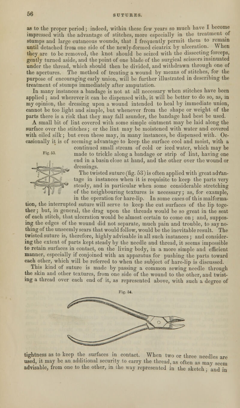 as to the proper period; indeed, within these few years so much have I become impressed with the advantage of stitches, more especially in the treatment of stumps and large cutaneous wounds, that I frequently permit them to remain until detached from one side of the newly-formed cicatrix by ulceration. When they are to be removed, the knot should be seized with the dissecting forceps, gently turned aside, and the point of one blade of the surgical scissors insinuated under the thread, which should then be divided, and withdrawn through one of the apertures. The method of treating a wound by means of stitches, for the purpose of encouraging early union, will be further illustrated in describing the treatment of stumps immediately after amputation. In many instances a bandage is not at all necessary when stitches have been applied; and wherever it can be dispensed with, it will be better to do so, as, in my opinion, the dressing upon a wound intended to heal by immediate union, cannot be too light and simple, but whenever from the shape or weight of the parts there is a risk that they may fall asunder, the bandage had best be used. A small bit of lint covered with some simple ointment may be laid along the surface over the stitches; or the lint may be moistened with water and covered with oiled silk; but even these may, in many instances, be dispensed with. Oc- casionally it is of seeming advantage to keep the surface cool and moist, with a continued small stream of cold or iced water, which may be made to trickle along a bandage or strip of lint, having one end in a basin close at hand, and the other over the wound or dressings. The twisted suture (fig. 53) is often applied with great advan- tage in instances when it is requisite to keep the parts very steady, and in particular when some considerable stretching of the neighbouring textures is necessary; as, for example, in the operation for hare-lip. In some cases of this malforma- tion, the interrupted suture will serve to keep the cut surfaces of the lip toge- ther ; but, in general, the drag upon the threads would be so great in the seat of each stitch, that ulceration would be almost certain to come on; and, suppos- ing the edges of the wound did not separate, much pain and trouble, to say no- thing of the unseemly scars that would follow, would be the inevitable result. The twisted suture is, therefore, highly advisable in all such instances; and consider- ing the extent of parts kept steady by the needle and thread, it seems impossible to retain surfaces in contact, on the living body, in a more simple and efficient manner, especially if conjoined with an apparatus for pushing the parts toward each other, which will be referred to when the subject of hare-lip is discussed. This kind of suture is made by passing a common sewing needle through the skin and other textures, from one side of the wound to the other, and twist- ing a thread over each end of it, as represented above, with such a degree of Fig. 51. tightness as to keep the surfaces in contact. When two or three needles are used, it may be an additional security to carry the thread, as often as may seem advisable, from one to the other, in the way represented in the sketch ■ and in