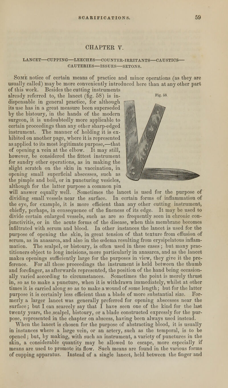 CHAPTER V. LANCET—CUPPING—LEECHES—COUNTER-IRRITANTS—CAUSTICS— CAUTERIES—ISSUES—SETONS. Some notice of certain means of practice and minor operations (as they are usually called) may be more conveniently introduced here than at any other part of this work. Besides the cutting instruments already referred to, the lancet (fig. 58) is in- Fis-58 dispensable in general practice, for although r its use has in a great measure been superseded 1;' by the bistoury, in the hands of the modern surgeon, it is undoubtedly more applicable to certain proceedings than any other sharp-edged instrument. The manner of holding it is ex- hibited on another page, where it is represented as applied to its most legitimate purpose,—that of opening a vein at the elbow. It may still, however, be considered the fittest instrument for sundry other operations, as in making the slight scratch on the skin in vaccination, in opening small superficial abscesses, such as the pimple and boil, or in puncturing vesicles, although for the latter purpose a common pin will answer equally well. Sometimes the lancet is used for the purpose of dividing small vessels near the surface. In certain forms of inflammation of the eye, for example, it is more efficient than any other cutting instrument, chiefly, perhaps, in consequence of the fineness of its edge. It may be used to divide certain enlarged vessels, such as are so frequently seen in chronic con- junctivitis, or in the acute forms of the disease, when this membrane becomes infiltrated with serum and blood. In other instances the lancet is used for the purpose of opening the skin, in great tension of that texture from effusion of serum, as in anasarca, and also in the oedema resulting from erysipelatous inflam- mation. The scalpel, or bistoury, is often used in these cases; but many prac- titioners object to long incisions, more particularly in anasarca, and as the lancet makes openings sufficiently large for the purposes in view, they give it the pre- ference. For all these proceedings the instrument is held between the thumb and forefinger, as afterwards represented, the position of the hand being occasion- ally varied according to circumstances. Sometimes the point is merely thrust in, so as to make a puncture, when it is withdrawn immediately, whilst at other times it is carried along so as to make a wound of some length; but for the latter purpose it is certainly less efficient than a blade of more substantial size. For- merly a larger lancet was generally preferred for opening abscesses near the surface; but I can scarcely say that I have seen one of the kind for the last twenty years, the.scalpel, bistoury, or a blade constructed expressly for the pur- pose, represented in the chapter on abscess, having been always used instead. When the lancet is chosen for the purpose of abstracting blood, it is usually in instances where a large vein, or an artery, such as the temporal, is to be opened ; but, by making, with such an instrument, a variety of punctures in the skin, a considerable quantity may be allowed to escape, more especially if means are used to promote its flow. Such means are found in the various forms of cupping apparatus. Instead of a single lancet, held between the finger and