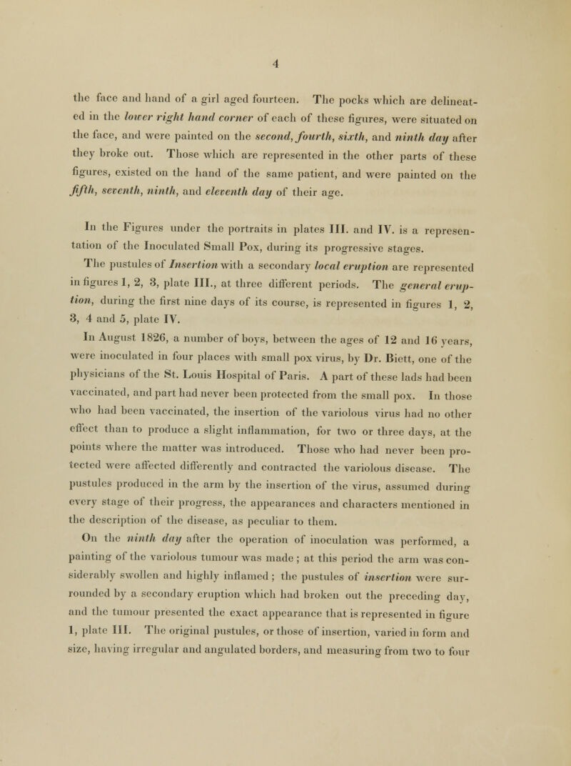 the face and hand of a girl aged fourteen. The pocks which are delineat- ed in the lower right hand corner of each of these figures, were situated on the face, and were painted on the second, fourth, sixth, and ninth day after they broke out. Those which are represented in the other parts of these figures, existed on the hand of the same patient, and were painted on the fifth, seventh, ninth, and eleventh day of their age. In the Figures under the portraits in plates III. and IV. is a represen- tation of the Inoculated Small Pox, during its progressive stages. The pustules of Insertion with a secondary local eruption are represented in figures 1, 2, 3, plate III., at three different periods. The general erup- tion, during the first nine days of its course, is represented in figures 1, 2, 3, 4 and 5, plate IV. In August 1826, a number of boys, between the ages of 12 and 16 years, were inoculated in four places with small pox virus, by Dr. Biett, one of the physicians of the St. Louis Hospital of Paris. A part of these lads had been vaccinated, and part had never been protected from the small pox. In those who had been vaccinated, the insertion of the variolous virus had no other effect than to produce a slight inflammation, for two or three days, at the points where the matter was introduced. Those who had never been pro- tected were affected differently and contracted the variolous disease. The pustules produced in the arm by the insertion of the virus, assumed during every stage of their progress, the appearances and characters mentioned in the description of the disease, as peculiar to them. On the ninth day after the operation of inoculation was performed, a painting of the variolous tumour was made ; at this period the arm was con- siderably swollen and highly inflamed ; the pustules of insertion were sur- rounded by a secondary eruption which had broken out the preceding day, and the tumour presented the exact appearance that is represented in figure 1, plate III. The original pustules, or those of insertion, varied in form and size, having irregular and angulated borders, and measuring from two to four