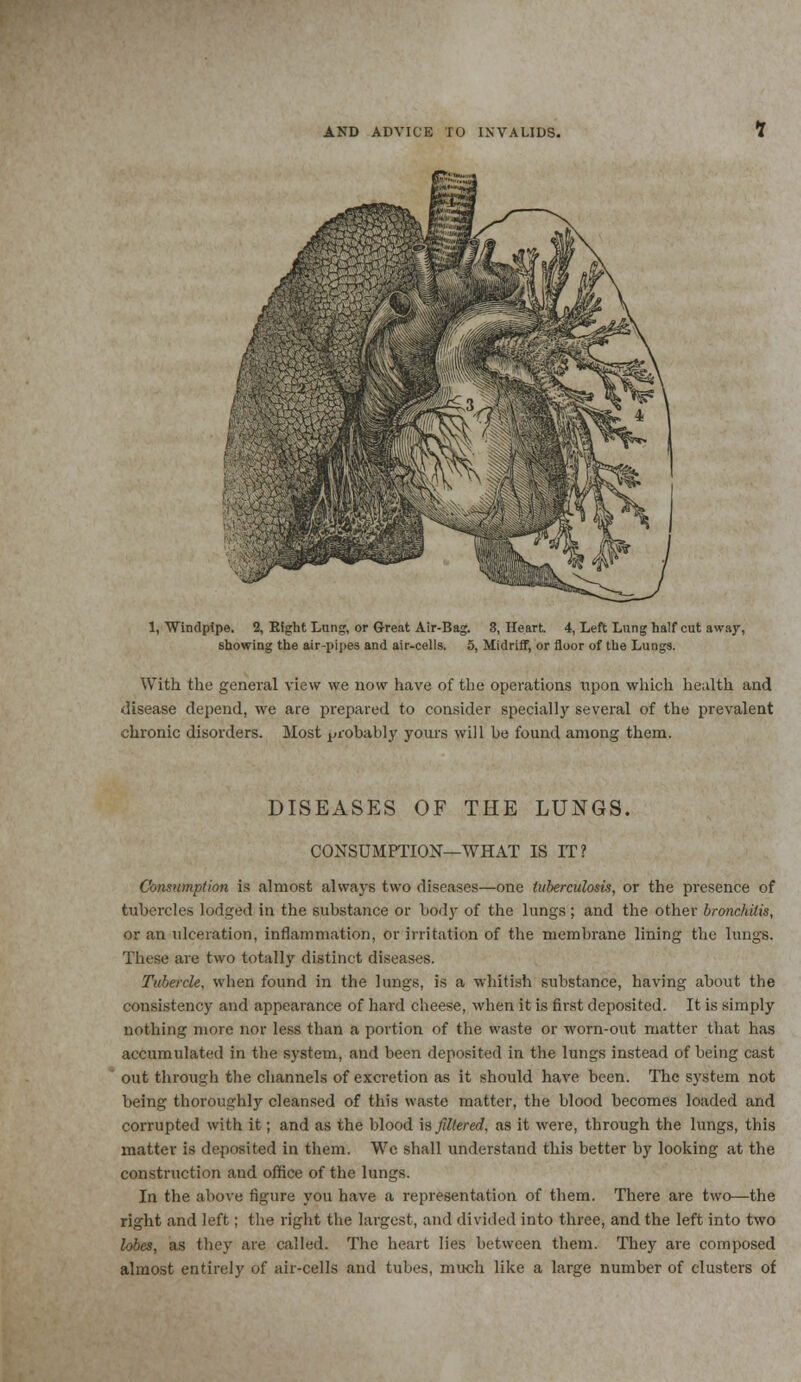 1, Windpipe. 2, Right Lung, or Great Air-Bag. 3, Heart. 4, Left Lung half cut away, showing the air-pipes and air-cells. 5, Midriff, or floor of the Lungs. With the general view we now have of the operations upon which health and disease depend, we are prepared to consider specially several of the prevalent chronic disorders. Most probably yours will be found among them. DISEASES OF THE LUNGS. CONSUMPTION—WHAT IS IT? Consumption is almost always two diseases—one tuberculosis, or the presence of tubercles lodged in the substance or body of the lungs; and the other bronc/uti.% or an ulceration, inflammation, or irritation of the membrane lining the lungs. These are two totally distinct diseases. Tubercle, when found in the lungs, is a whitish substance, having about the consistency and appearance of hard cheese, when it is first deposited. It is simply nothing more nor less than a portion of the waste or worn-out matter that has accumulated in the system, and been deposited in the lungs instead of being cast out through the channels of excretion as it should have been. The system not being thoroughly cleansed of this waste matter, the blood becomes loaded and corrupted with it; and as the blood is filtered, as it were, through the lungs, this matter is deposited in them. Wc shall understand this better by looking at the construction and office of the lungs. In the above figure you have a representation of them. There are two—the right and left; the right the largest, and divided into three, and the left into two lobes, as they are called. The heart lies between them. They are composed almost entirely of air-cells and tubes, much like a large number of clusters of
