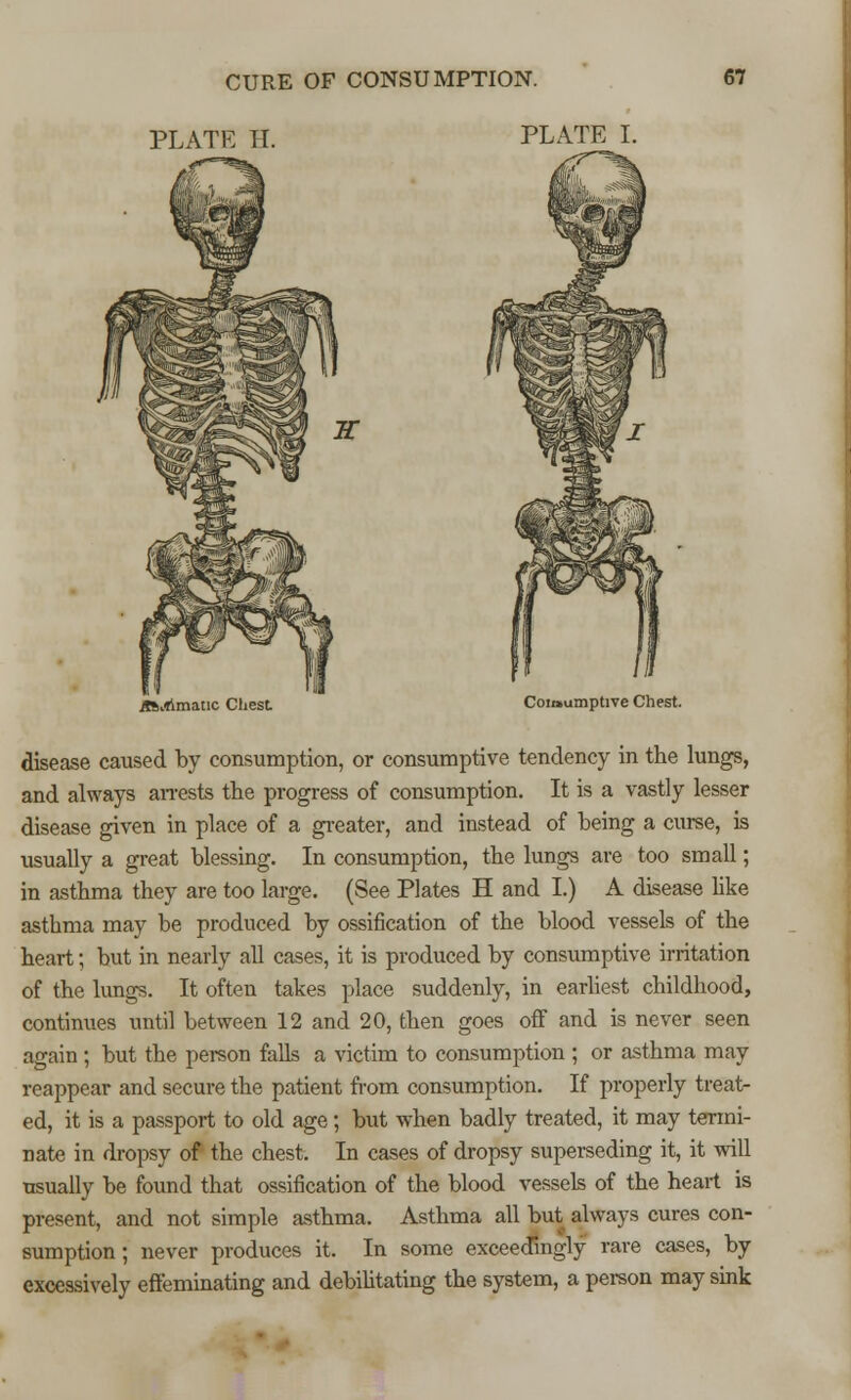 PLATE H. PLATE I. ifintflmatic Chest Consumptive Chest. disease caused by consumption, or consumptive tendency in the lungs, and always arrests the progress of consumption. It is a vastly lesser disease given in place of a greater, and instead of being a curse, is usually a great blessing. In consumption, the lungs are too small; in asthma they are too large. (See Plates H and I.) A disease like asthma may be produced by ossification of the blood vessels of the heart; but in nearly all cases, it is produced by consumptive irritation of the lungs. It often takes place suddenly, in earliest childhood, continues until between 12 and 20, then goes off and is never seen again; but the person falls a victim to consumption ; or asthma may reappear and secure the patient from consumption. If properly treat- ed, it is a passport to old age; but when badly treated, it may termi- nate in dropsy of the chest. In cases of dropsy superseding it, it will usually be found that ossification of the blood vessels of the heart is present, and not simple asthma. Asthma all but always cures con- sumption ; never produces it. In some exceedingly rare cases, by excessively effeminating and debilitating the system, a person may sink