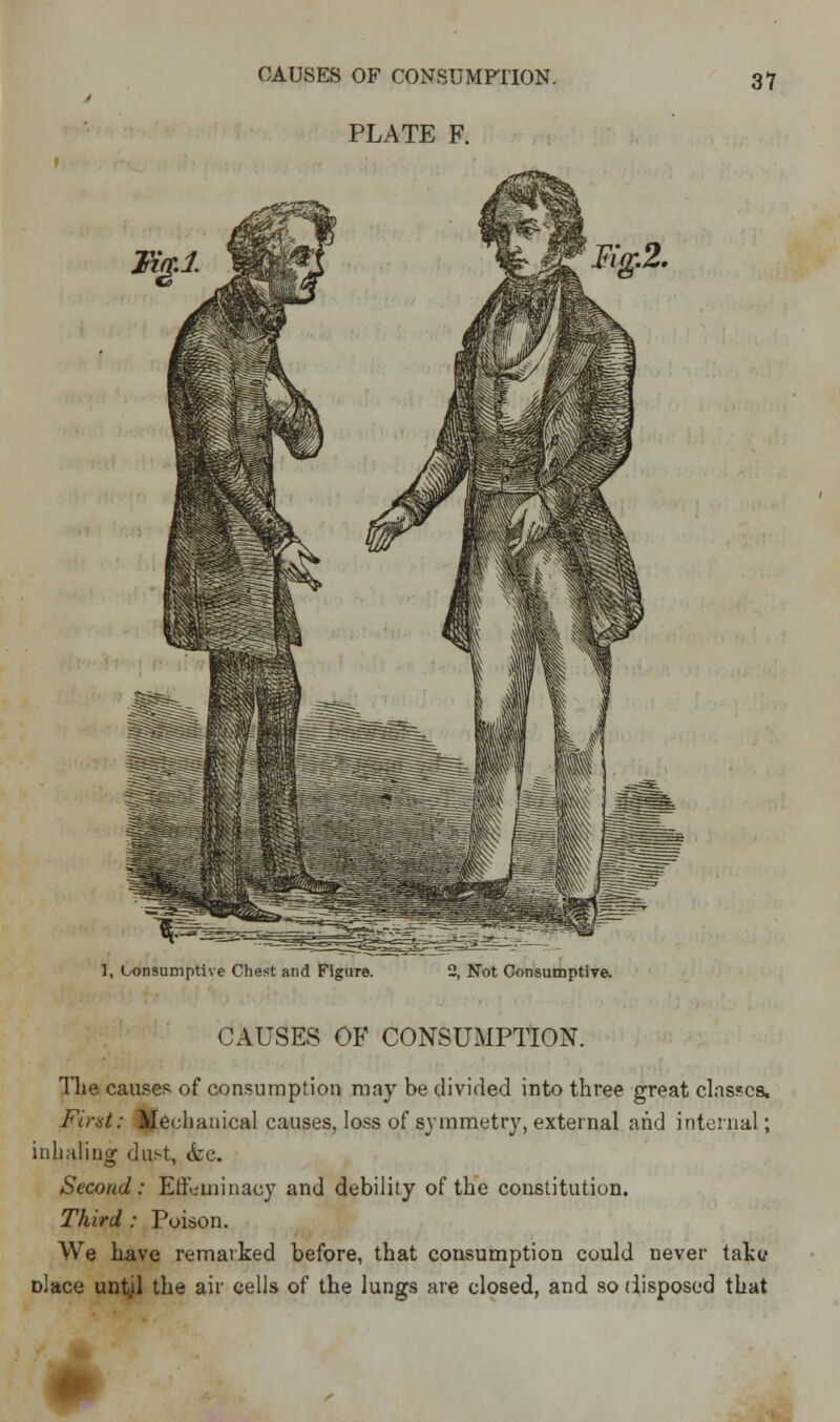PLATE F. 31 I, Consumptive Chest and Figure. 2, Not Consumptive. CAUSES OF CONSUMPTION. The causes of consumption may be divided into three great classes. First: Mechanical causes, loss of symmetry, external and internal; inhaling dust, &c. Second: Effeminacy and debility of the constitution. Third : Poison. We have remarked before, that consumption could never take Dlace untjl the air cells of the lungs are closed, and so disposed that
