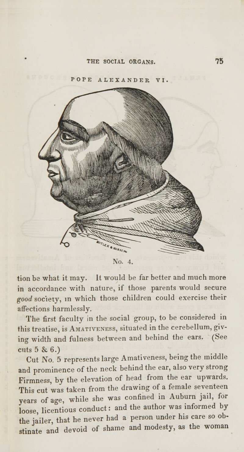 THE SOCIAL ORGANS. POPE ALEXANDER VI, 75 tionbe what it may. It would be far better and much more in accordance with nature, if those parents would secure good society, in which those children could exercise their affections harmlessly. The first faculty in the social group, to be considered in this treatise, is Amativeness, situated in the cerebellum, giv- ing width and fulness between and behind the ears. (See cuts 5 & 6.) Cut No. 5 represents large Amativeness, being the middle and prominence of the neck behind the ear, also very strong Firmness, by the elevation of head from the ear upwards. This cut was taken from the drawing of a female seventeen years of age, while she was confined in Auburn jail, for loose, licentious conduct: and the author was informed by the jailer, that he never had a person under his care so ob- stinate and devoid of shame and modesty, a.s the woman