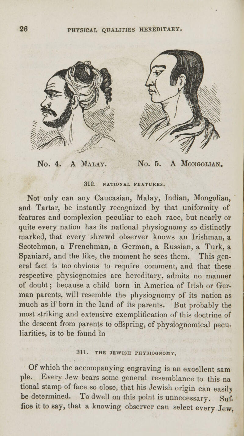 No. 5. A Mongolian. 31Q. NATIONAL FEATURES. Not only can any Caucasian, Malay, Indian, Mongolian, and Tartar, be instantly recognized by that uniformity of features and complexion peculiar to each race, but nearly or quite every nation has its national physiognomy so distinctly marked, that every shrewd observer knows an Irishman, a Scotchman, a Frenchman, a German, a Russian, a Turk, a Spaniard, and the like, the moment he sees them. This gen- eral fact is too obvious to require comment, and that these respective physiognomies are hereditary, admits no manner of doubt; because a child born in America of Irish or Ger- man parents, will resemble the physiognomy of its nation as much as if born in the land of its parents. But probably the most striking and extensive exemplification of this doctrine of the descent from parents to offspring, of physiognomical pecu- liarities, is to be found in 311. THE JEWISH PHYSIOGNOMY, Of which the accompanying engraving is an excellent sam pie. Every Jew bears some general resemblance to this na tional stamp of face so close, that his Jewish origin can easily be determined. To dwell on this point is unnecessary. Suf- fice it to say, that a knowing observer can select every Jew