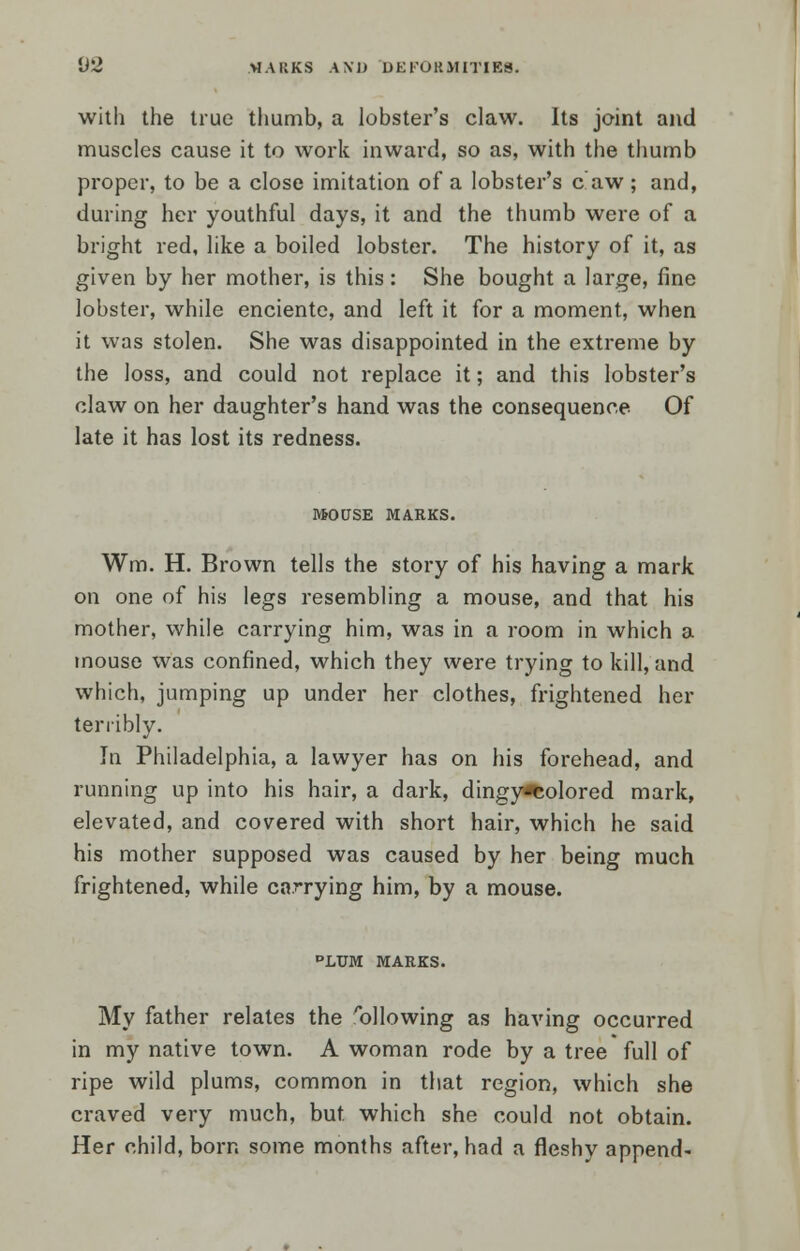 with the true thumb, a lobster's claw. Its joint and muscles cause it to work inward, so as, with the thumb proper, to be a close imitation of a lobster's caw; and, during her youthful days, it and the thumb were of a bright red, like a boiled lobster. The history of it, as given by her mother, is this: She bought a large, fine lobster, while enciente, and left it for a moment, when it was stolen. She was disappointed in the extreme by the loss, and could not replace it; and this lobster's claw on her daughter's hand was the consequence Of late it has lost its redness. MOUSE MARKS. Wm. H. Brown tells the story of his having a mark on one of his legs resembling a mouse, and that his mother, while carrying him, was in a room in which a mouse was confined, which they were trying to kill, and which, jumping up under her clothes, frightened her terribly. In Philadelphia, a lawyer has on his forehead, and running up into his hair, a dark, dingy^olored mark, elevated, and covered with short hair, which he said his mother supposed was caused by her being much frightened, while carrying him, by a mouse. °LUM MARKS. My father relates the C6\lowing as having occurred in my native town. A woman rode by a tree full of ripe wild plums, common in that region, which she craved very much, but which she could not obtain. Her child, born some months after, had a fleshy append-