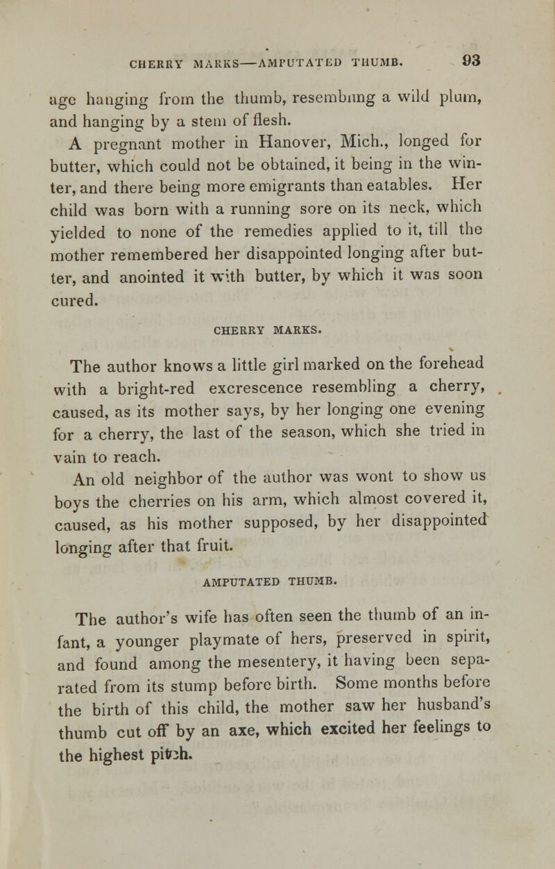 CHERRY MARKS AMPUTATED THUMB. 03 age hanging from the thumb, resembling a wild plum, and hanging by a stem of flesh. A pregnant mother in Hanover, Mich., longed for butter, which could not be obtained, it being in the win- ter, and there being more emigrants than eatables. Her child was born with a running sore on its neck, which yielded to none of the remedies applied to it, till the mother remembered her disappointed longing after but- ter, and anointed it with butter, by which it was soon cured. CHERRY MARKS. The author knows a little girl marked on the forehead with a bright-red excrescence resembling a cherry, caused, as its mother says, by her longing one evening for a cherry, the last of the season, which she tried in vain to reach. An old neighbor of the author was wont to show us boys the cherries on his arm, which almost covered it, caused, as his mother supposed, by her disappointed longing after that fruit. AMPUTATED THUMB. The author's wife has often seen the thumb of an in- fant, a younger playmate of hers, preserved in spirit, and found among the mesentery, it having been sepa- rated from its stump before birth. Some months before the birth of this child, the mother saw her husband's thumb cut off by an axe, which excited her feelings to the highest pitoh.