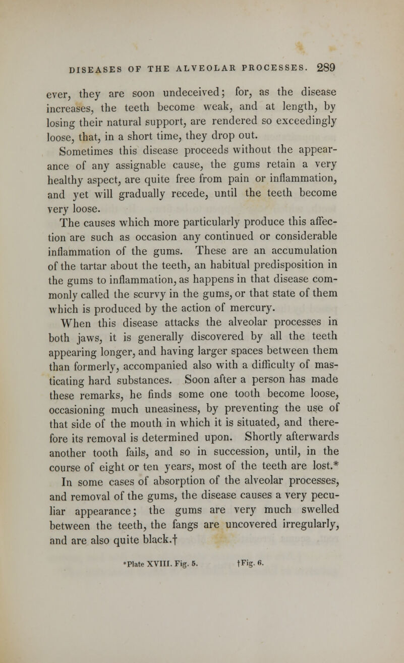 ever, they are soon undeceived; for, as the disease increases, the teeth become weak, and at length, by losing their natural support, are rendered so exceedingly loose, that, in a short time, they drop out. Sometimes this disease proceeds without the appear- ance of any assignable cause, the gums retain a very healthy aspect, are quite free from pain or inflammation, and yet will gradually recede, until the teeth become very loose. The causes which more particularly produce this affec- tion are such as occasion any continued or considerable inflammation of the gums. These are an accumulation of the tartar about the teeth, an habitual predisposition in the gums to inflammation, as happens in that disease com- monly called the scurvy in the gums, or that state of them which is produced by the action of mercury. When this disease attacks the alveolar processes in both jaws, it is generally discovered by all the teeth appearing longer, and having larger spaces between them than formerly, accompanied also with a difficulty of mas- ticating hard substances. Soon after a person has made these remarks, he finds some one tooth become loose, occasioning much uneasiness, by preventing the use of that side of the mouth in which it is situated, and there- fore its removal is determined upon. Shortly afterwards another tooth fails, and so in succession, until, in the course of eight or ten years, most of the teeth are lost.* In some cases of absorption of the alveolar processes, and removal of the gums, the disease causes a very pecu- liar appearance; the gums are very much swelled between the teeth, the fangs are uncovered irregularly, and are also quite black.f *Plate XVIII. Fig. 5. \Tig. G.