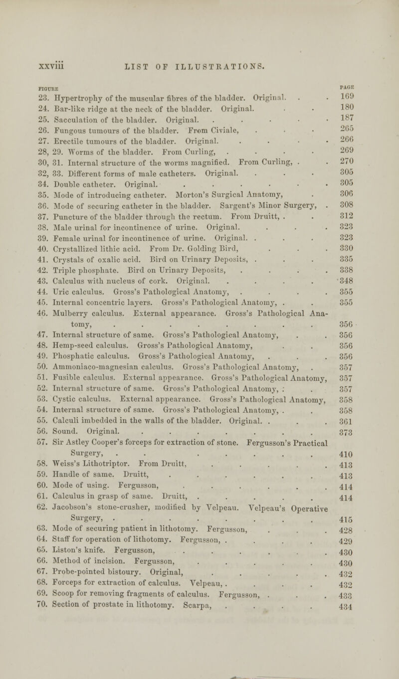 FIQUHE PA0E 23. Hypertrophy of the muscular fibres of the bladder. Original. . . 100 24. Bar-like ridge at the neck of the bladder. Original. . . 180 25. Sacculation of the bladder. Original. . 187 26. Fungous tumours of the bladder. From Civiale, . • • 266 27. Erectile tumours of the bladder. Original. .... 26G 28. 29. Worms of the bladder. From Curling, .... 269 30, 31. Internal structure of the worms magnified. From Curling, . . 270 32, 33. Different forms of male catheters. Original. ... 305 34. Double catheter. Original. ...••• 305 35. Mode of introducing catheter. Morton's Surgical Anatomy, . 306 3G. Mode of securing catheter in the bladder. Sargent's Minor Surgery, . 308 37. Puncture of the bladder through the rectum. From Druitt, . . 312 38. Male urinal for incontinence of urine. Original. . . . 323 39. Female urinal for incontinence of urine. Original. . . . 323 40. Crystallized lithic acid. From Dr. Golding Bird, . . .330 41. Crystals of oxalic acid. Bird on Urinary Deposits, . . . 335 42. Triple phosphate. Bird on Urinary Deposits, .... 338 43. Calculus with nucleus of cork. Original. .... '348 44. Uric calculus. Gross's Pathological Anatomy, .... 355 45. Internal concentric layers. Gross's Pathological Anatomy, . . 355 46. Mulberry calculus. External appearance. Gross's Pathological Ana- tomy, ........ 356 47. Internal structure of same. Gross's Pathological Anatomy, . . 356 48. Hemp-seed calculus. Gross's Pathological Anatomy, . . 356 49. Phosphatic calculus. Gross's Pathological Anatomy, . . . 356 50. Ammoniaco-magnesian calculus. Gross's Pathological Anatomy, . 357 51. Fusible calculus. External appearance. Gross's Pathological Anatomy, 357 52. Internal structure of same. Gross's Pathological Anatomy, ; . 357 53. Cystic calculus. External appearance. Gross's Pathological Anatomy, 358 54. Internal structure of same. Gross's Pathological Anatomy, . . 358 55. Calculi imbedded in the walls of the bladder. Original. . . . 361 56. Sound. Original. ....... 373 57. Sir Astley Cooper's forceps for extraction of stone. Fergusson's Practical Surgery, . . ..... 410 58. Weiss's Lithotriptor. From Druitt, . . . . .413 59. Handle of same. Druitt, ...... 413 60. Mode of using. Fergusson, ■••.... 414 61. Calculus in grasp of same. Druitt, ..... 414 62. Jacobson's stone-crusher, modified by Velpeau. Velpeau's Operative Surgery, ........ 415 63. Mode of securing patient in lithotomy. Fergusson, . . 428 64. Staff for operation of lithotomy. Fergusson, .... 429 65. Liston's knife. Fergusson, . . . . 43O 66. Method of incision. Fergusson, ..... 430 67. Probe-pointed bistoury. Original, ..... 432 68. Forceps for extraction of calculus. Velpeau, .... 432 69. Scoop for removing fragments of calculus. Fergusson, . . . 433 70. Section of prostate in lithotomy. Scarpa, .... 434
