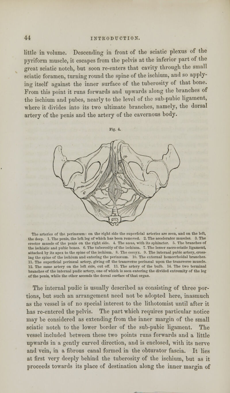 little in volume. Descending in front of the sciatic plexus of the pyriform muscle, it escapes from the pelvis at the inferior part of the great sciatic notch, but soon re-enters that cavity through the small sciatic foramen, turning round the spine of the ischium, and so apply- ing itself against the inner surface of the tuberosity of that bone. From this point it runs forwards and upwards along the branches of the ischium and pubes, nearly to the level of the sub-pubic ligament, where it divides into its two ultimate branches, namely, the dorsal artery of the penis and the artery of the cavernous body. The arteries of the perinoeum: on the right side the superficial arteries are seen, and on the left, the deep. 1. The penis, the left leg of which has heen removed. 2. The accelerator muscles. 3. The erector muscle of the penis on the right side. 4. The anus, with its sphincter. 5. The branches of the ischiatic and pubic bones. 6. The tuberosity of the ischium. 7. The lesser sacro-sciatic ligament, attached by its apex to the spine of the ischium. 8. The coccyx. 9. The internal pubic artery, cross- ing the spine of the ischium and entering the perinaeum. 10. The external hemorrhoidal branches. 11. The superficial pcrinseal artery, giving off the transverse perinseal upon the transverse muscle. 12. The same artery on the left side, cut off. 13. The artery of the bulb. 14. The two terminal branches of the internal pudic artery, one of which is seen entering the divided extremity of the leg of the penis, while the other ascends the dorsal surface of that organ. The internal pudic is usually described as consisting of three por- tions, but such an arrangement need not be adopted here, inasmuch as the vessel is of no special interest to the lithotomist until after it has re-entered the pelvis. The part which requires particular notice may be considered as extending from the inner margin of the small sciatic notch to the lower border of the sub-pubic ligament. The vessel included between these two points runs forwards and a little upwards in a gently curved direction, and is enclosed, with its nerve and vein, in a fibrous canal formed in the obturator fascia. It lies at first very deeply behind the tuberosity of the ischium, but as it proceeds towards its place of destination along the inner margin of