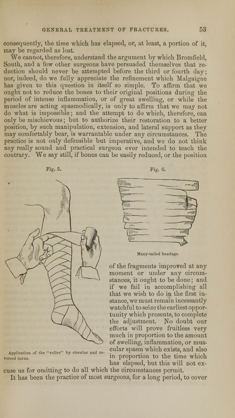 consequently, the time which has elapsed, or, at least, a portion of it, may be regarded as lost. We cannot, therefore, understand the argument by which Bromfield, South, and a few other surgeons have persuaded themselves that re- duction should never be attempted before the third or fourth day; nor, indeed, do we fully appreciate the refinement which Malgaigne has given to this question in itself so simple. To affirm that we ought not to reduce the bones to their original positions during the period of intense inflammation, or of great swelling, or while the muscles are acting spasmodically, is only to affirm that we may not do what is impossible; and the attempt to do which, therefore, can only be mischievous; but to authorize their restoration to a better position, by such manipulation, extension, and lateral support as they may comfortably bear, is warrantable under any circumstances. The practice is not only defensible but imperative, and we do not think any really sound and practical surgeon ever intended to teach the contrary. We say still, if bones can be easily reduced, or the position Fig. 5. Fig. 6. Many-tailed bandage. of the fragments improved at any moment or under any circum- stances, it ought to be done; and if we fail in accomplishing all that we wish to do in the first in- stance, we must remain incessantly watchful to seize the earliest oppor- tunity which presents, to complete the adjustment. No doubt our efforts will prove fruitless very much in proportion to the amount of swelling, inflammation, or mus- cular spasm which exists, and also in proportion to the time which has elapsed, but this will not ex- cuse us for omitting to do all which the circumstances permit. It has been the practice of most surgeons, for a long period, to cover Application of the versed turns. 'roller by circular and re-