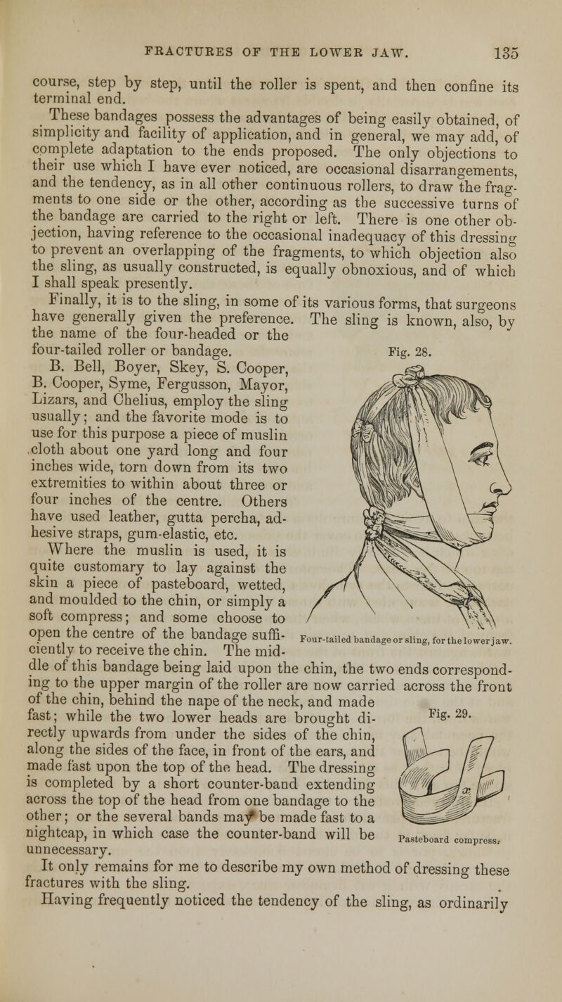 course, step by step, until the roller is spent, and then confine its terminal end. These bandages possess the advantages of being easily obtained, of simplicity and facility of application, and in general, we may add,' of complete adaptation to the ends proposed. The only objections to their use which I have ever noticed, are occasional disarrangements, and the tendency, as in all other continuous rollers, to draw the frag- ments to one side or the other, according as the successive turns of the bandage are carried to the right or left. There is one other ob- jection, having reference to the occasional inadequacy of this dressing to prevent an overlapping of the fragments, to which objection also the sling, as usually constructed, is equally obnoxious, and of which I shall speak presently. Finally, it is to the sling, in some of its various forms, that surgeons have generally given the preference. The sling is known, also, by the name of the four-headed or the four-tailed roller or bandage. Fig. 28. B. Bell, Boyer, Skey, S. Cooper, B. Cooper, Syme, Fergusson, Mayor, Lizars, and Chelius, employ the sling usually; and the favorite mode is to use for this purpose a piece of muslin ,cloth about one yard long and four inches wide, torn down from its two extremities to within about three or four inches of the centre. Others have used leather, gutta percha, ad- hesive straps, gum-elastic, etc. Where the muslin is used, it is quite customary to lay against the skin a piece of pasteboard, wetted, and moulded to the chin, or simply a soft compress; and some choose to open the centre of the bandage suffi- ciently to receive the chin. The mid- dle of this bandage being laid upon the chin, the two ends correspond- ing to the upper margin of the roller are now carried across the front of the chin, behind the nape of the neck, and made fast; while the two lower heads are brought di- rectly upwards from under the sides of the chin, along the sides of the face, in front of the ears, and made fast upon the top of the head. The dressing is completed by a short counter-band extending across the top of the head from one bandage to the other; or the several bands may*be made fast to a nightcap, in which case the counter-band will be Pasteboard compress unnecessary. It only remains for me to describe my own method of dressing these fractures with the sling. Having frequently noticed the tendency of the sling, as ordinarily Four-tailed bandage or sling, for the lower jaw. Fig. 29.