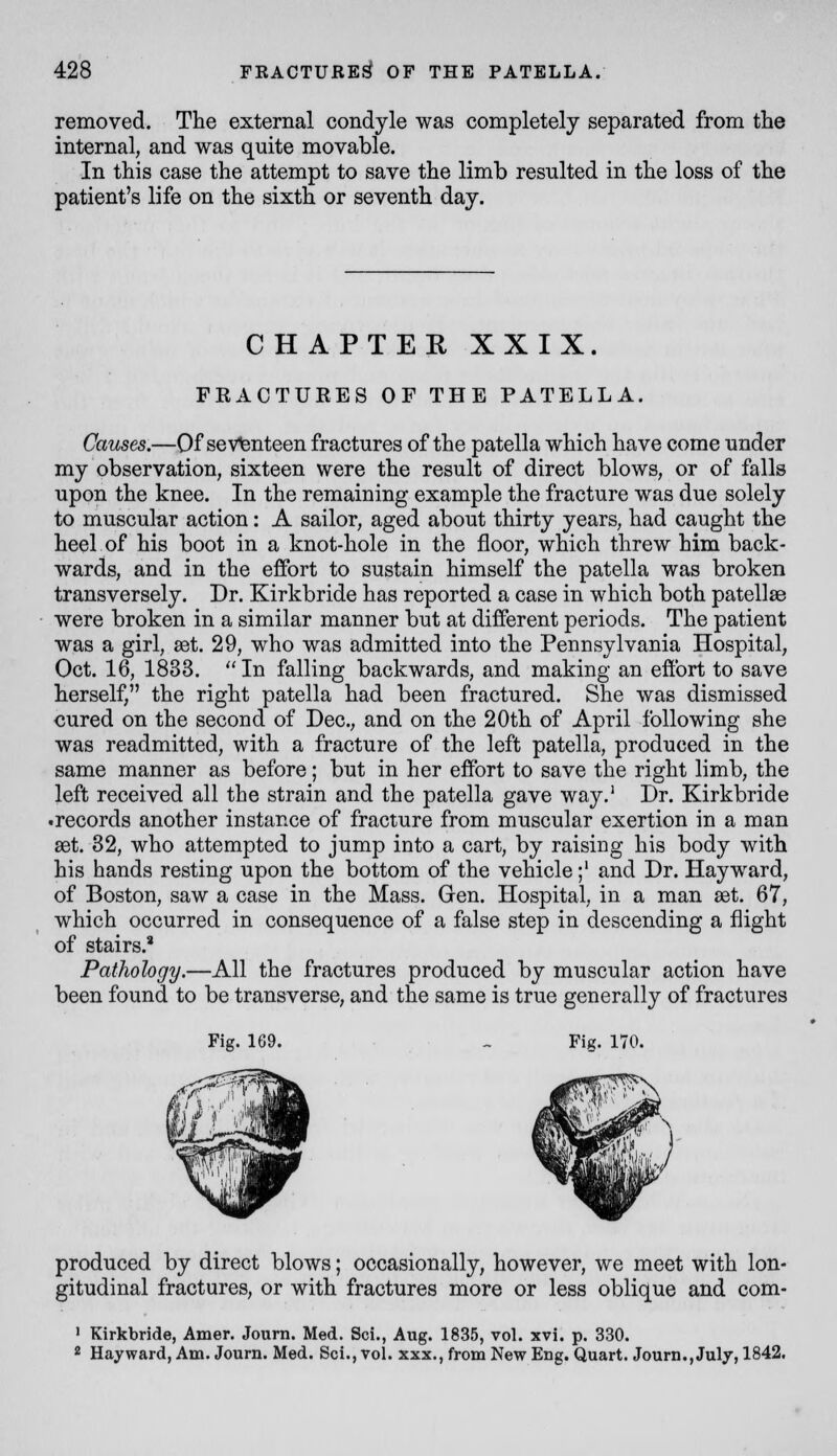 removed. The external condyle was completely separated from the internal, and was quite movable. In this case the attempt to save the limb resulted in the loss of the patient's life on the sixth or seventh day. CHAPTER XXIX. FKACTURES OF THE PATELLA. Causes.—Of seVtenteen fractures of the patella which have come under my observation, sixteen were the result of direct blows, or of falls upon the knee. In the remaining example the fracture was due solely to muscular action: A sailor, aged about thirty years, had caught the heel of his boot in a knot-hole in the floor, which threw him back- wards, and in the effort to sustain himself the patella was broken transversely. Dr. Kirkbride has reported a case in which both patellae were broken in a similar manner but at different periods. The patient was a girl, set. 29, who was admitted into the Pennsylvania Hospital, Oct. 16, 1833. In falling backwards, and making an effort to save herself, the right patella had been fractured. She was dismissed cured on the second of Dec, and on the 20th of April following she was readmitted, with a fracture of the left patella, produced in the same manner as before; but in her effort to save the right limb, the left received all the strain and the patella gave way.' Dr. Kirkbride •records another instance of fracture from muscular exertion in a man set. 82, who attempted to jump into a cart, by raising his body with his hands resting upon the bottom of the vehicle;' and Dr. Hay ward, of Boston, saw a case in the Mass. Gen. Hospital, in a man set. 67, which occurred in consequence of a false step in descending a flight of stairs.' Pathology.—All the fractures produced by muscular action have been found to be transverse, and the same is true generally of fractures Fig. 169. - Fig. 170. produced by direct blows; occasionally, however, we meet with lon- gitudinal fractures, or with fractures more or less oblique and com- ' Kirkbride, Amer. Journ. Med. Sci., Aug. 1835, vol. xvi. p. 330. * Hayward, Am. Journ. Med. Sci., vol. xxx., from New Eng. Quart. Journ., July, 1842.