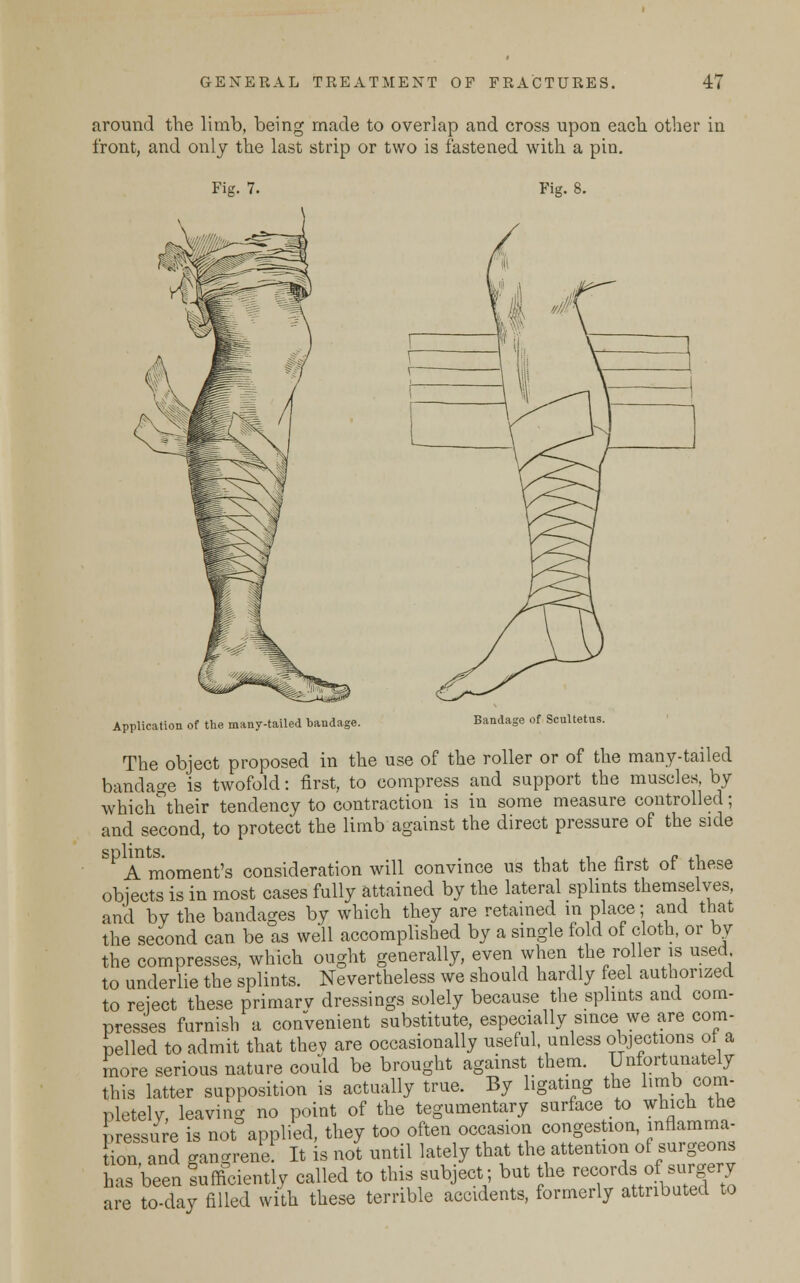 around the limb, being made to overlap and cross upon each other in front, and only the last strip or two is fastened with a piu. Fig. 7. Fig. 8. Bandasxe of Scultetus. Application of the many-tailed bandage. The object proposed in the use of the roller or of the many-tailed bandage is twofold: first, to compress and support the muscles, by which°their tendency to contraction is in some measure controlled; and second, to protect the limb against the direct pressure of the side SP A moment's consideration will convince us that the first of these obiects is in most cases fully attained by the lateral splints themselves, and by the bandages by which they are retained in place; and that the second can be as well accomplished by a single fold of cloth, or by the compresses, which ought generally, even when the roller is used, to underlie the splints. Nevertheless we should hardly feel authorized to reject these primary dressings solely because the splints and com- presses furnish a convenient substitute, especially since we are com- pelled to admit that they are occasionally useful unless objections of a more serious nature could be brought against them. Unfortunately this latter supposition is actually true. By ligating the limb com- pletely, leaving no point of the tegumentary surface to which the pressure is not applied, they too often occasion congestion, inflamma- tion, and gangrene! It is not until lately that the attention of surgeons has been Sufficiently called to this subject; but the records of.surgery are to-day filled with these terrible accidents, formerly attributed to