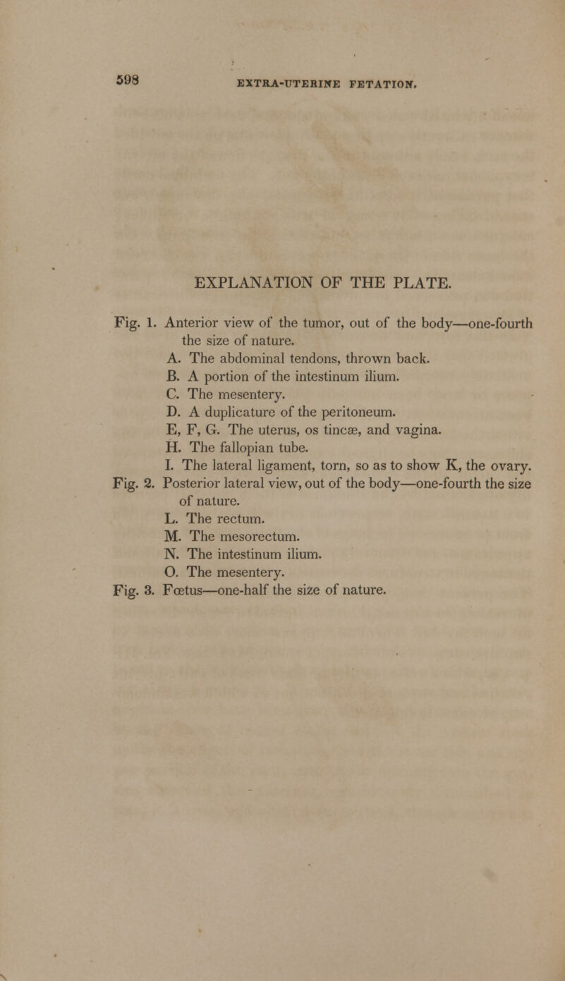 EXPLANATION OF THE PLATE. Fig. 1. Anterior view of the tumor, out of the body—one-fourth the size of nature. A. The abdominal tendons, thrown back. B. A portion of the intestinum ilium. C. The mesentery. D. A duplicature of the peritoneum. E. F, G. The uterus, os tincse, and vagina. H. The fallopian tube. I. The lateral ligament, torn, so as to show K, the ovary. Fig. 2. Posterior lateral view, out of the body—one-fourth the size of nature. L. The rectum. M. The mesorectum. N. The intestinum ilium. O. The mesentery. Fig. 3. Foetus—one-half the size of nature.