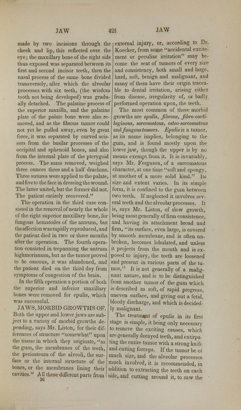 made by two incisions through the cheek and Up, this reflected over the eye; the maxillary bone of the right side thus exposed was separated between its first and second incisor teeth, then the nasal process of the same bone divided transversely, after which the alveolar processes with six teeth, (the wisdom tooth not being developed) was gradu- ally detached. The palatine process of the superior maxilla, and the palatine plate of the palate bone were also re- moved, and as the fibrous tumor could not yet be pulled away, even by great force, it was separated by curved scis- sors from the basilar processes of the occipital and sphenoid bones, and also from the internal plate of the pterygoid process. The mass removed, weighed three ounces three and a half drachms. Three sutures were applied to the palate, and five to the face in dressing the wound. The latter united, but the former did not. The patient entirely recovered. The operation in the third case con- sisted in the removal of nearly the whole of the right superior maxUlary bone, for fungous hematodes of the antrum, but theaffectionwas rapidly reproduced, and the patient died in two or three months after the operation. The fourth opera- tion consisted in trepanning the antrum highmorianum, but as the tumor proved to be osseous, it was abandoned, and the patient died on the third day from symptoms of congestion of the brain. In the fifth operation a portion of both the superior and inferior maxillary bones were removed for epulis, which was successful. JAWS, MORBID GROWTHS OF. Both the upper and lower jaws are sub- ject to a variety of morbid growths de- pending, says Mr. Liston, for their dif- ferences of structure somewhat upon the tissue in which they originate, as the gum, the membranes of the teeth, the periosteum of the alveoU, the sur- face or the internal structure of the bones, or the membranes fining their external injury, or, according to Dr. Koecker, from some accidental excite- ment or peculiar irritation may be- come the seat of tumors of every size and consistency, both small and large, hard, soft, benign and malignant, and many of them have their origin tracea- ble to dental irritation, arising either from disease, irregularity of, or badly performed operation upon, the teeth. I The most common of these morbid growths are epulis, fibrous, Jibro-carti- laginous, sarcomatous, ostco-sarcomatous and fungous tumors. Epulis is a tumor, as its name impHes, belonging to the gum, and is found mostly upon the lower jaw, though the upper is by no means exempt from it. It is invariably, says Mr. Ferguson, of a sarcomatous character, at one time soft and spongy, at another of a more soHd kind. Its size and extent varies. In its simple form, it is confined to the gum between two teeth. If neglected it involves sev- eral teeth and the alveolar processes. It is, says Mr. Liston, of slow growth, being most generally of firm consistence, and having its attachment broad and firm, its surface, even large, is covered by smooth membrane, and is often un- broken, becomes lobulated, and unless it projects from the mouth and is ex- posed to injury, the teeth are loosened and present in various parts of the tu- mor. It is not generally of a malig- nant nature, and is to be distinguished from another tumor of the gum which is described as soft, of rapid progress, uneven surface, and giving out a fetid, bloody discharge, and which is decided- ly mahgnant. The treatmiftnt of epulis in its first stage is simple, it being only necessary to remove the exciting causes, which are generally decayed teeth, and extirpa ting the entire tumor with a strong knife and cutting forceps. If the tumor be oi much size, and the alveolar processes much involved, it is recommended, in addition to extracting the teeth on each cavities. Allthesedifferentparts from!side, and cutting around it, to saw the